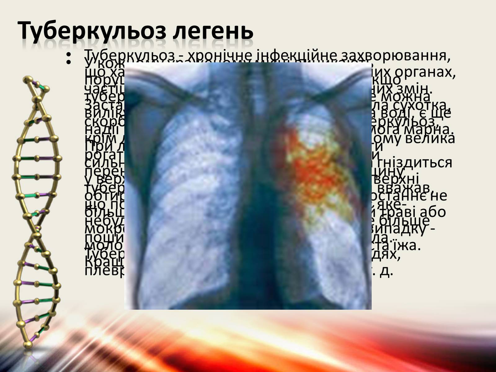 Презентація на тему «Захворювання дихальної системи» (варіант 1) - Слайд #20
