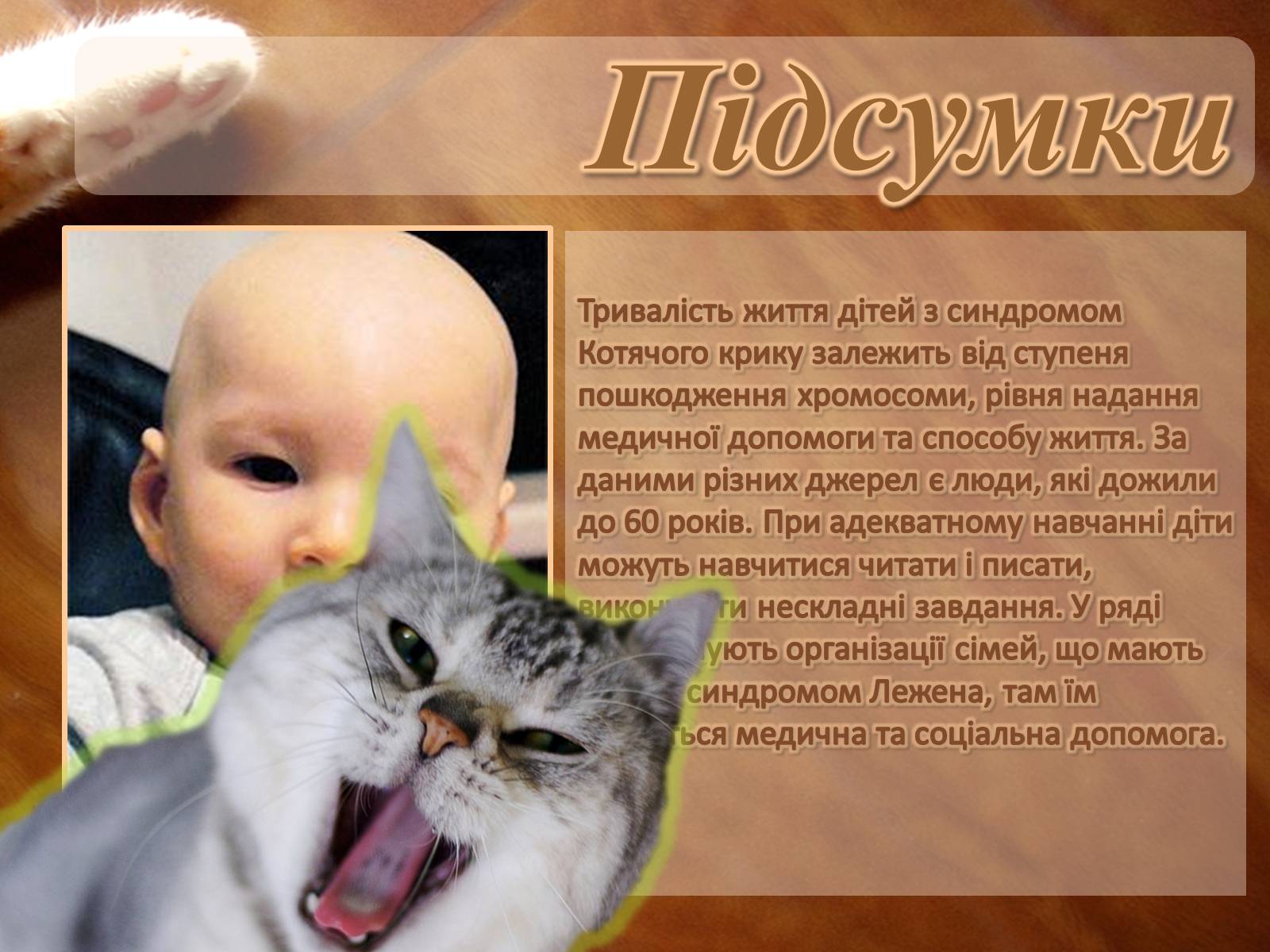 Презентація на тему «Синдром котячого крику» - Слайд #7