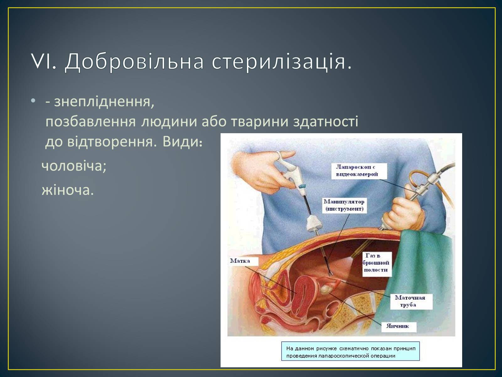 Презентація на тему «Контрацепція» (варіант 1) - Слайд #14