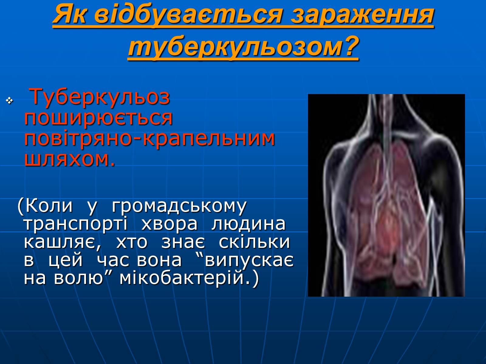 Презентація на тему «Проблема туберкульозу в Україні» - Слайд #5