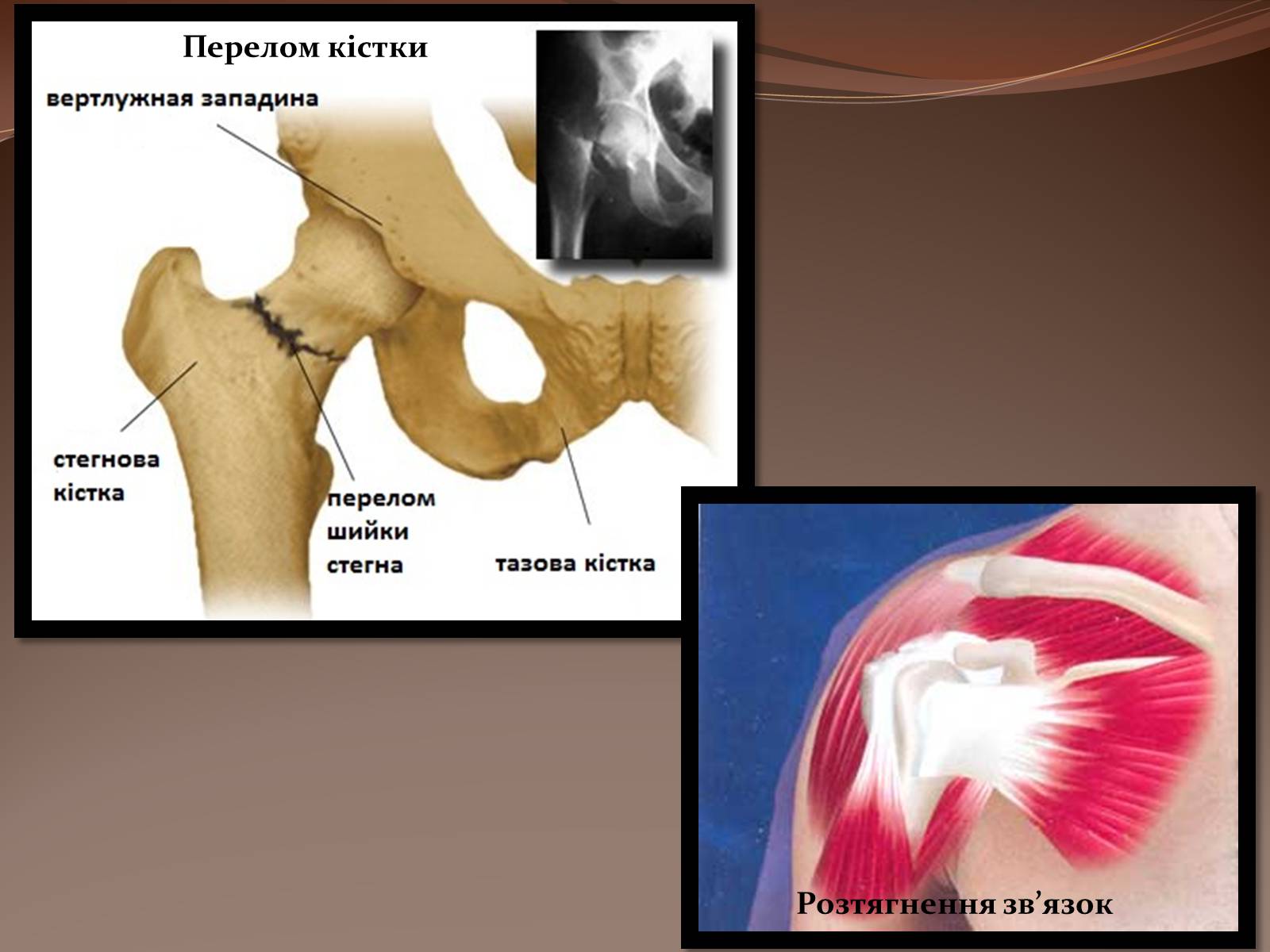 Презентація на тему «Травма систем організму» (варіант 1) - Слайд #11