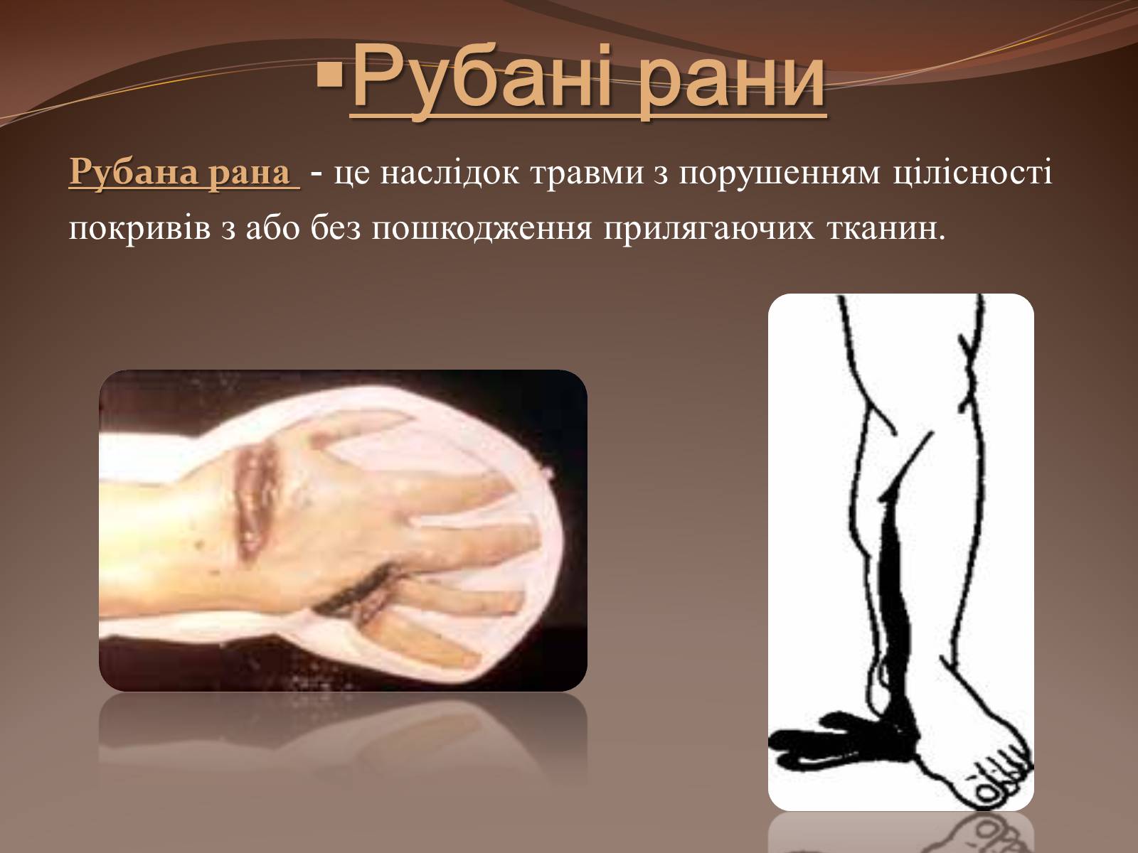 Презентація на тему «Травма систем організму» (варіант 1) - Слайд #19
