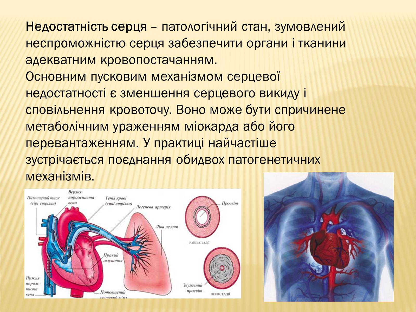 Презентація на тему «Захворювання серцево-судинної системи» (варіант 3) - Слайд #10