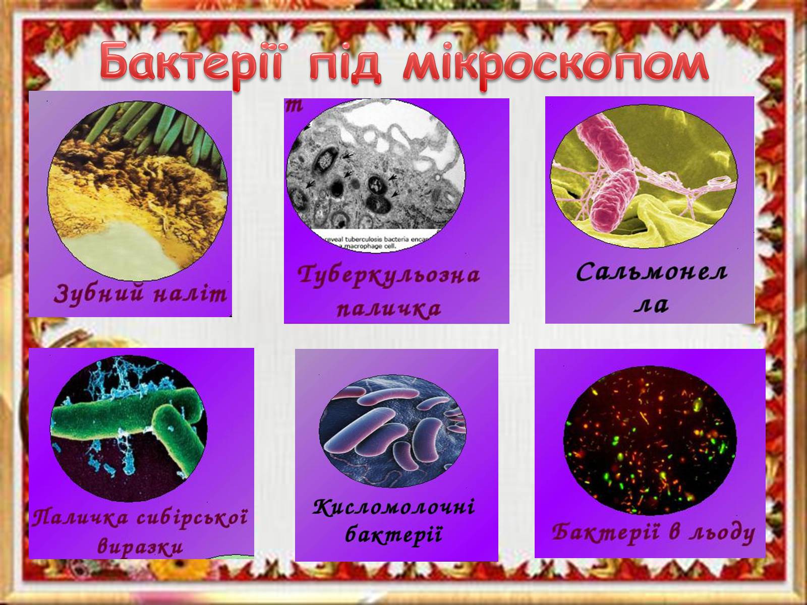 Презентація на тему «Бактерії» (варіант 3) - Слайд #11