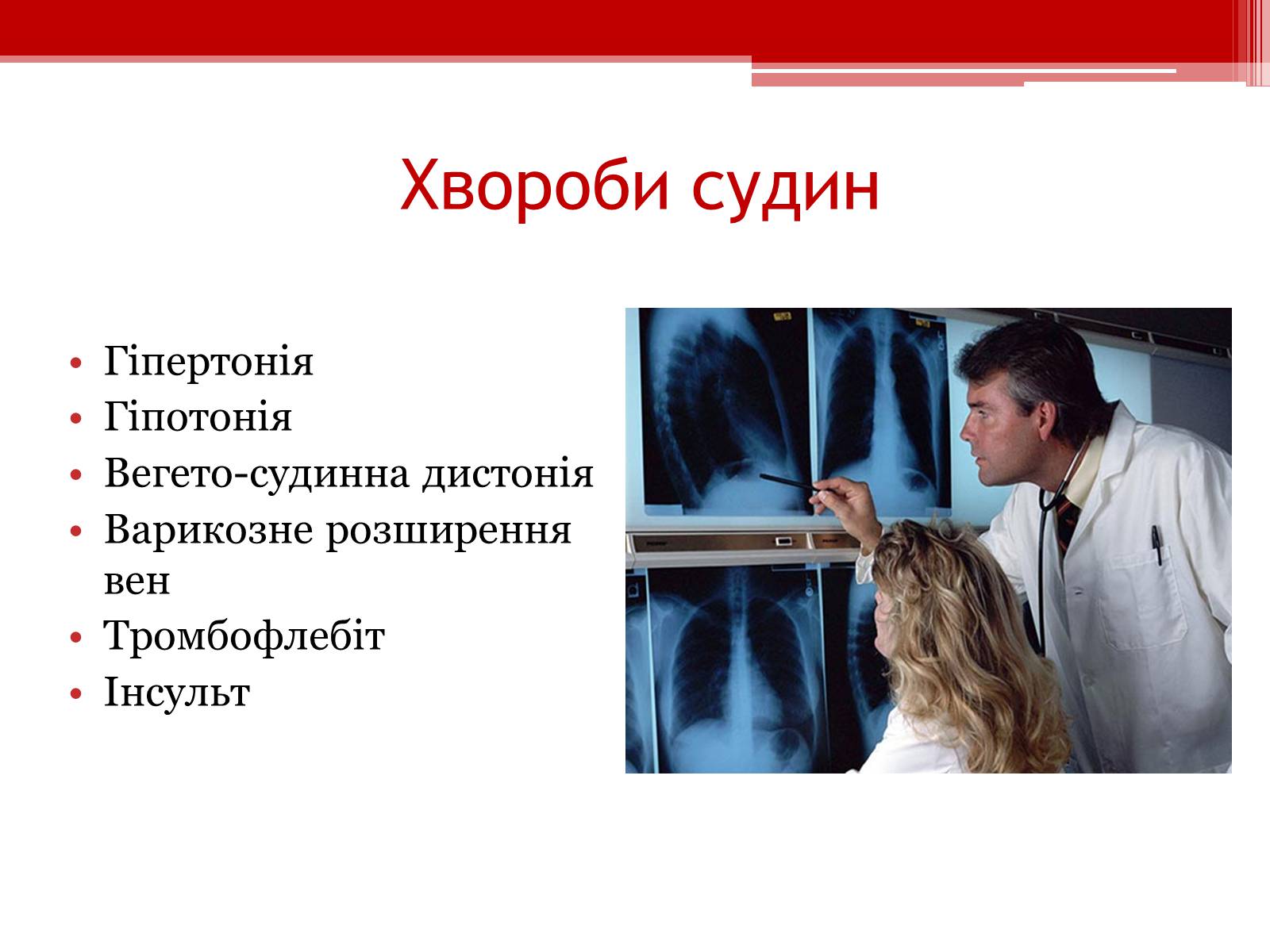 Презентація на тему «Захворювання серцево – судинної системи. Профілактика» - Слайд #8
