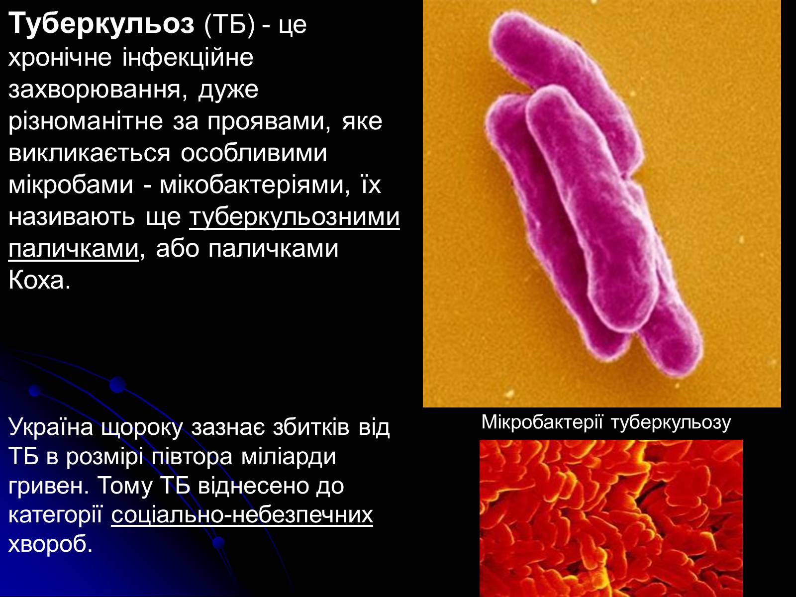 Презентація на тему «Туберкульоз» (варіант 4) - Слайд #3