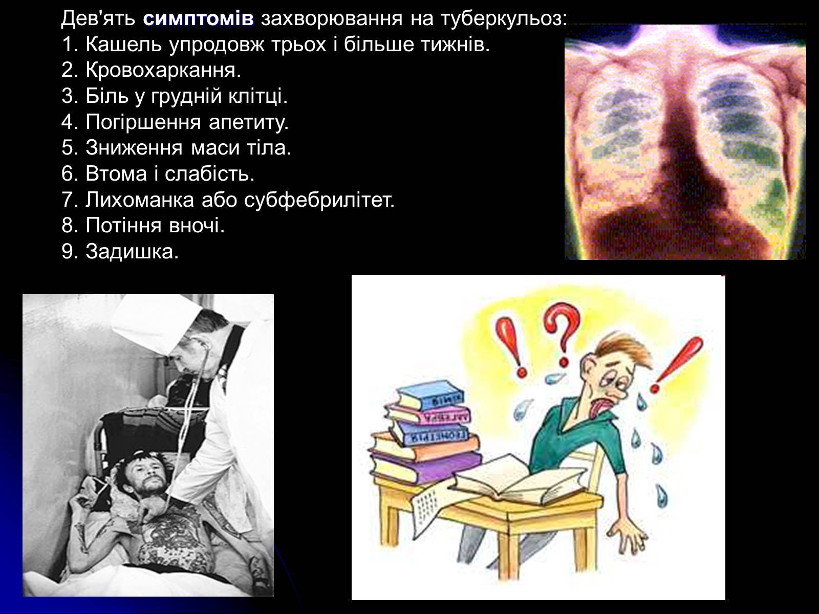 Презентація на тему «Туберкульоз» (варіант 4) - Слайд #5