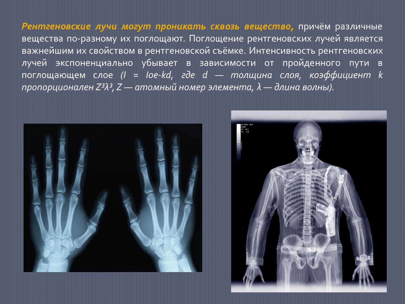 Презентація на тему «Рентгеновское излучение» - Слайд #7