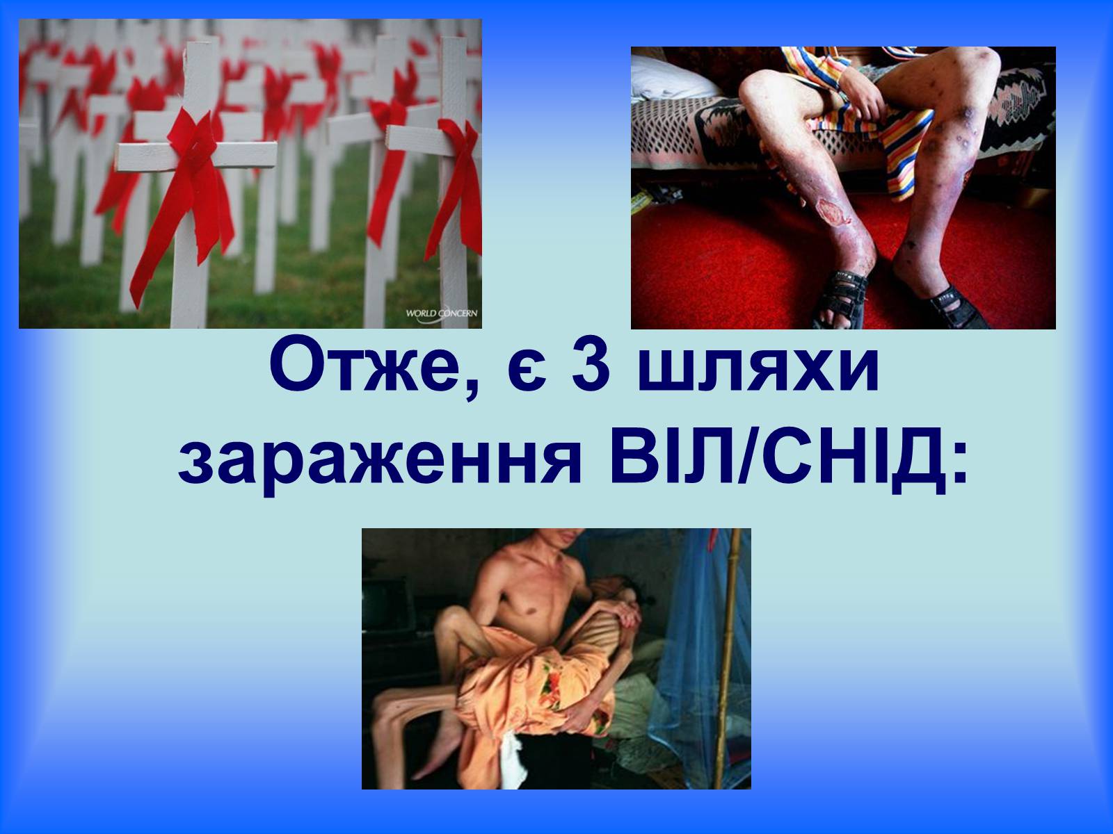 Презентація на тему «ВІЛ. СНІД. інфекції ІПСШ: шляхи передачі і методи захисту» (варіант 6) - Слайд #13
