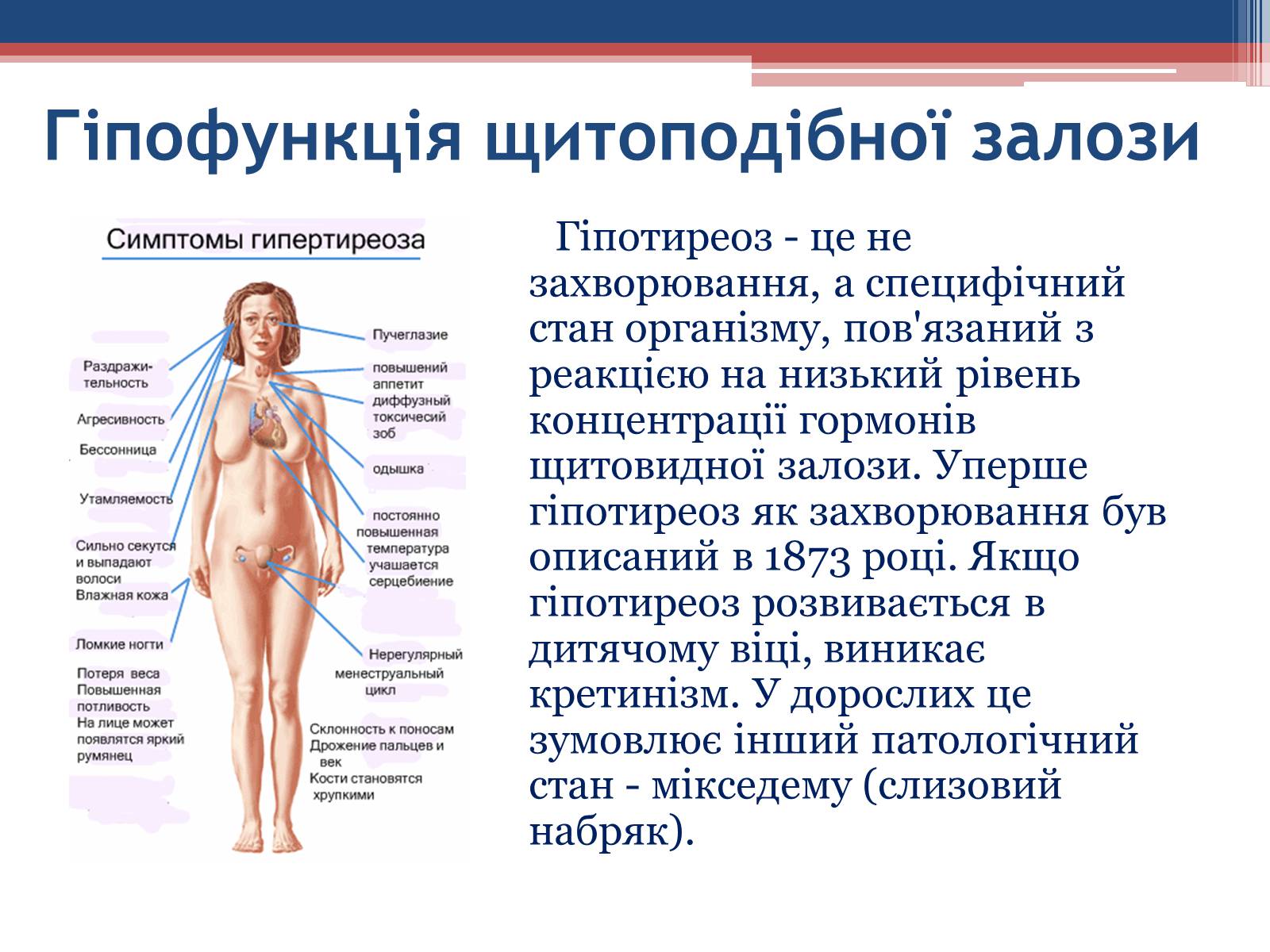 Презентація на тему «Порушення гормональних функцій ендокринних залоз» - Слайд #9