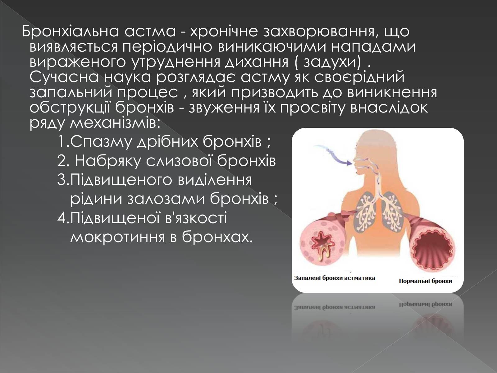 Презентація на тему «Види професійних захворювань органів дихання» - Слайд #8