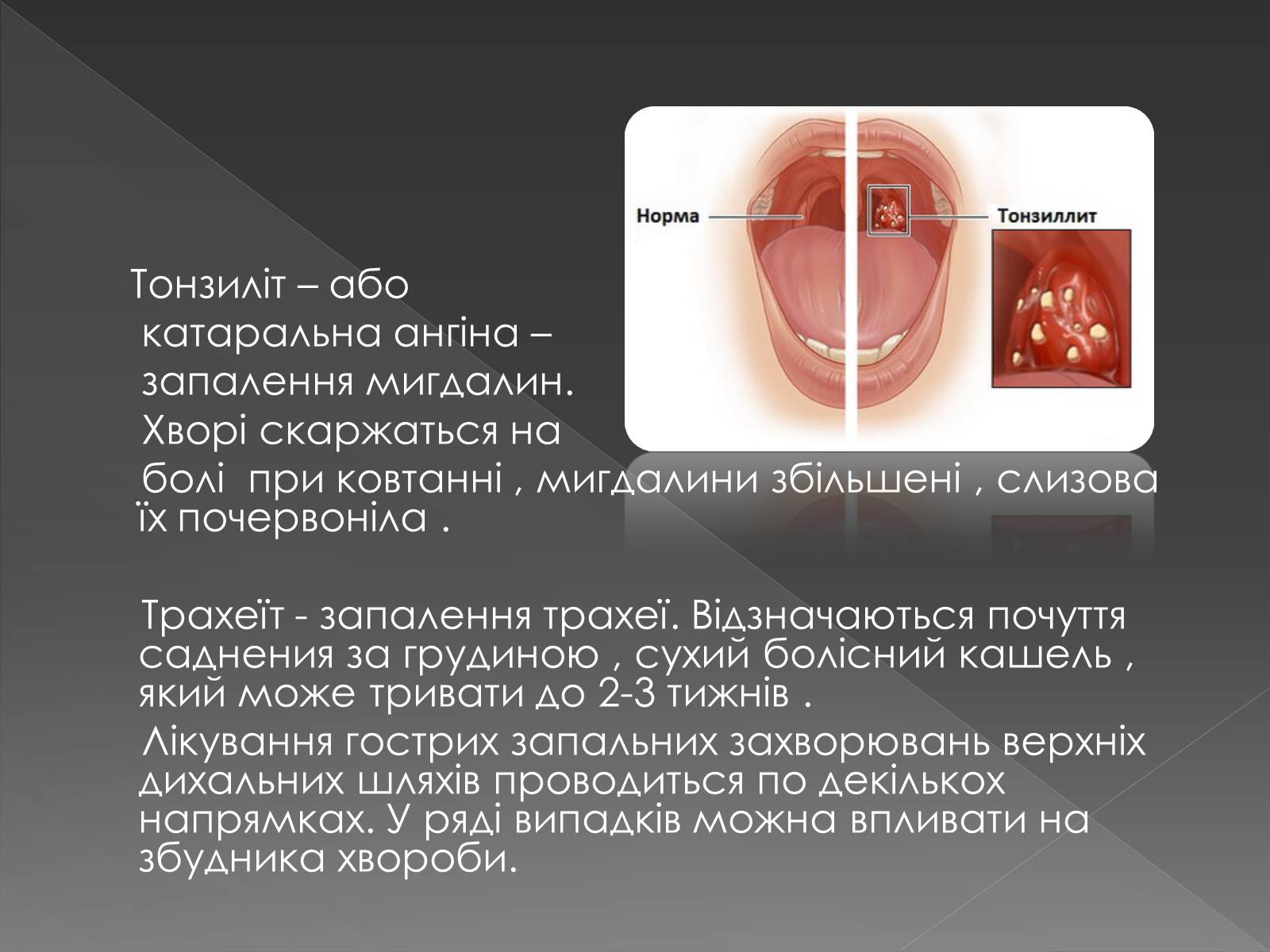 Презентація на тему «Види професійних захворювань органів дихання» - Слайд #14