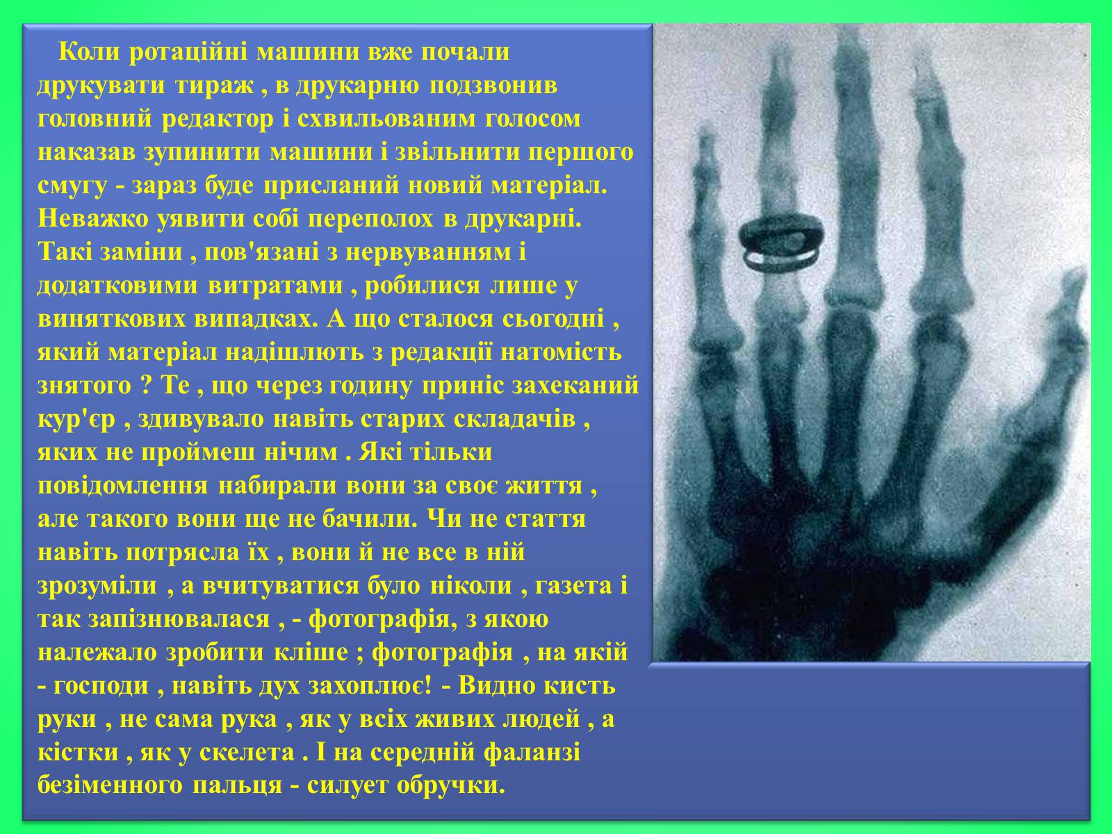Презентація на тему «Рентгенівське випромінювання» (варіант 6) - Слайд #4