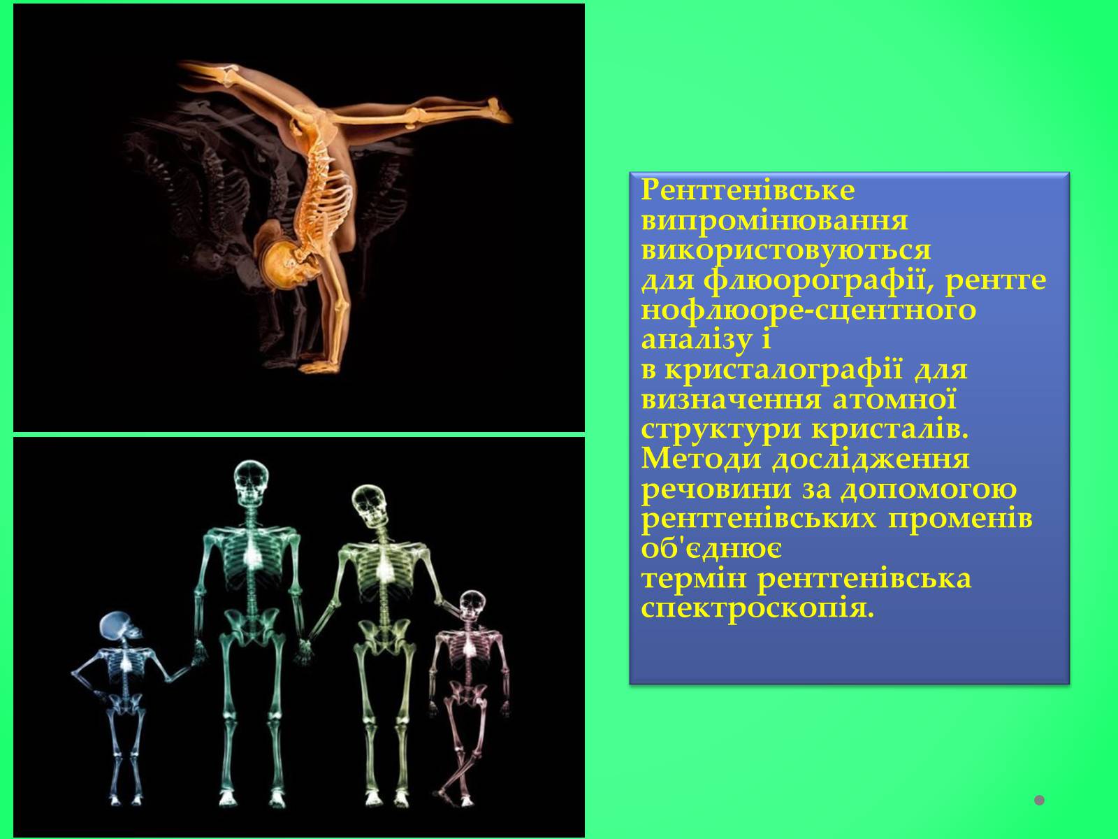 Презентація на тему «Рентгенівське випромінювання» (варіант 6) - Слайд #8