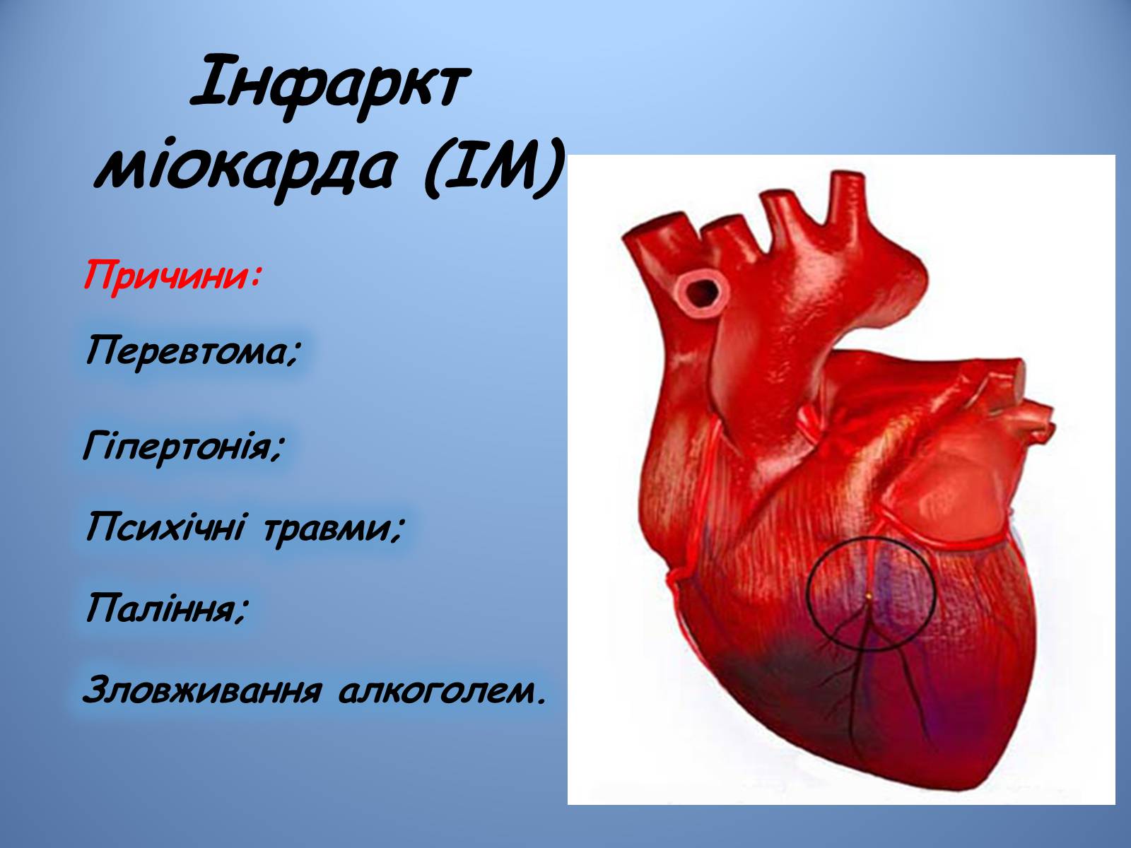 Презентація на тему «Порушення діяльності серцево-судинної системи» - Слайд #4