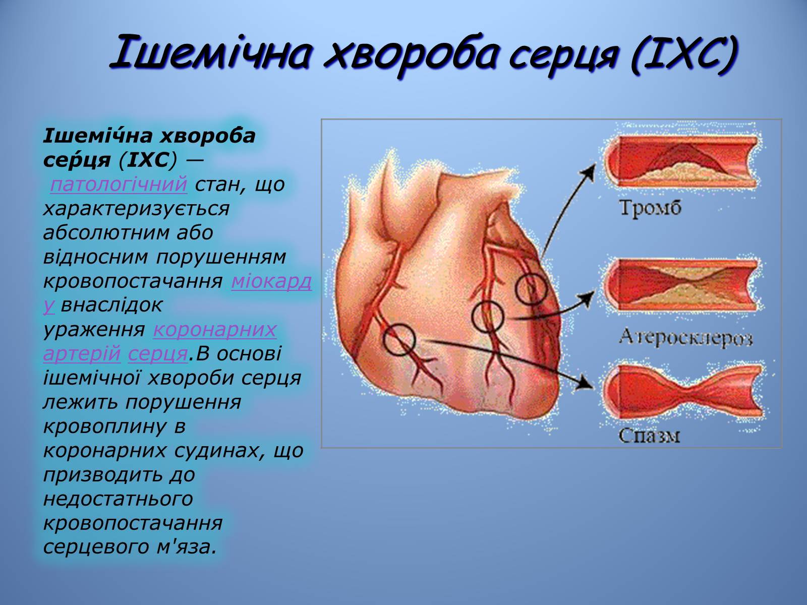Презентація на тему «Порушення діяльності серцево-судинної системи» - Слайд #7