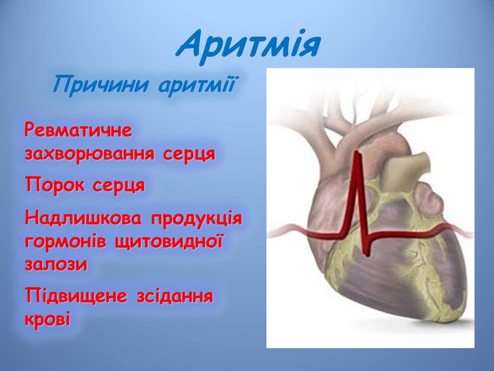 Презентація на тему «Порушення діяльності серцево-судинної системи» - Слайд #11