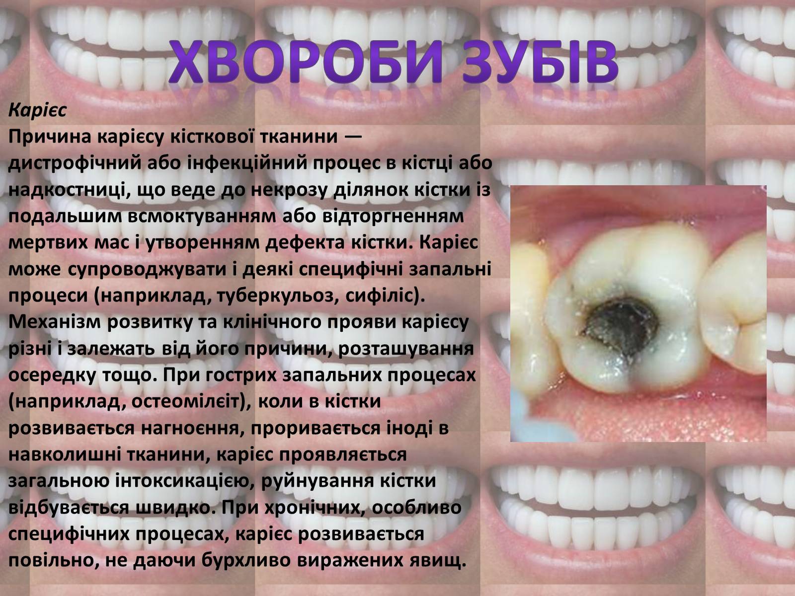 Презентація на тему «Зуби» (варіант 2) - Слайд #7