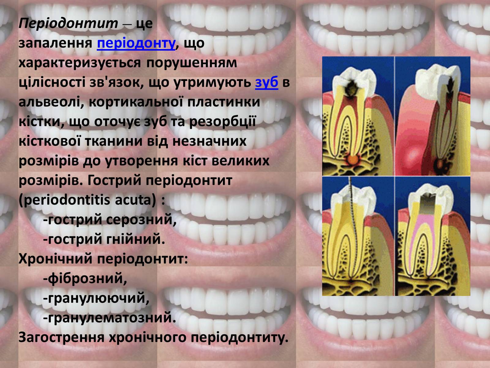 Презентація на тему «Зуби» (варіант 2) - Слайд #9