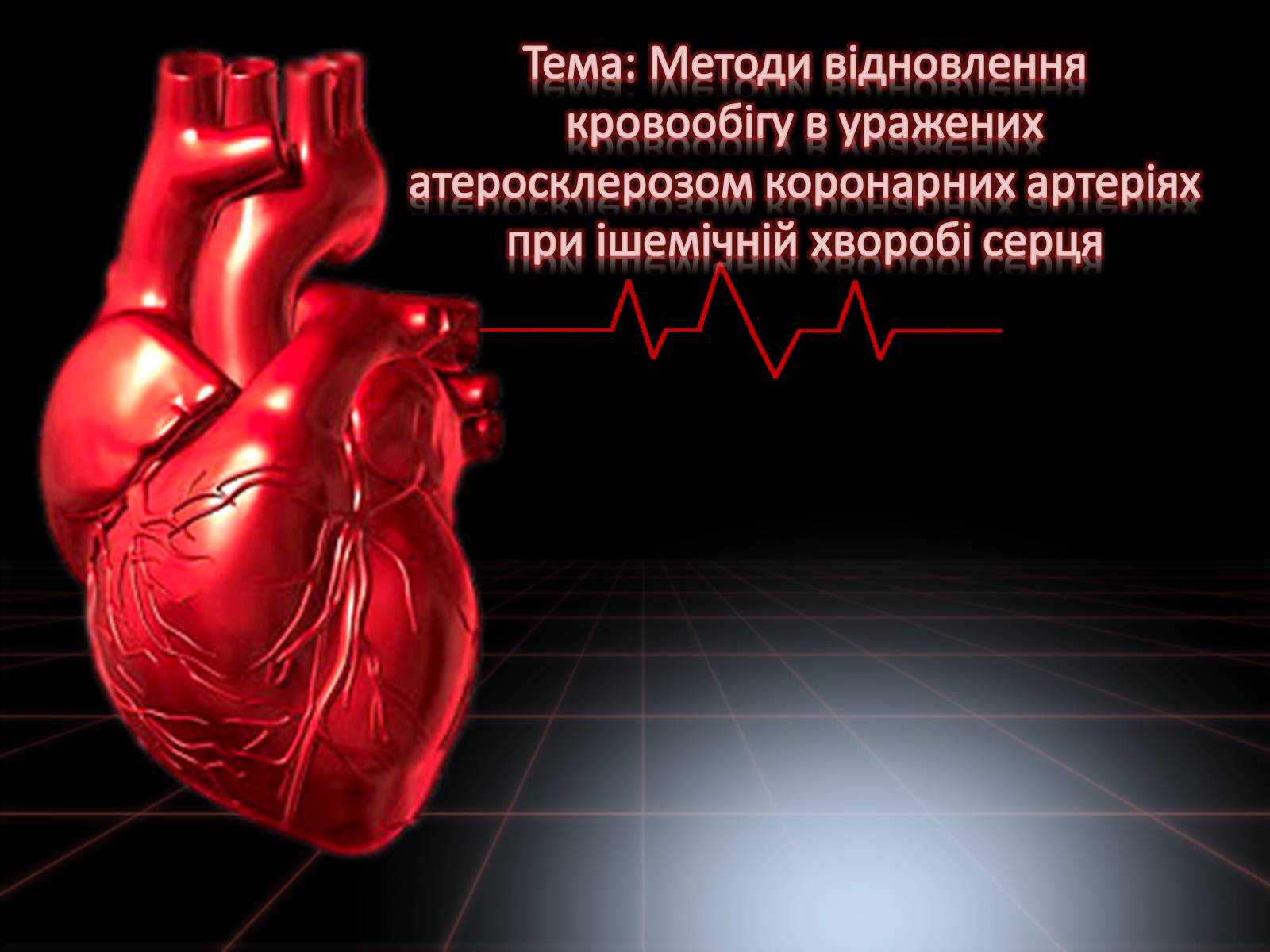 Презентація на тему «Методи відновлення кровообігу в уражених атеросклерозом коронарних артеріях при ішемічній хворобі серця» - Слайд #1