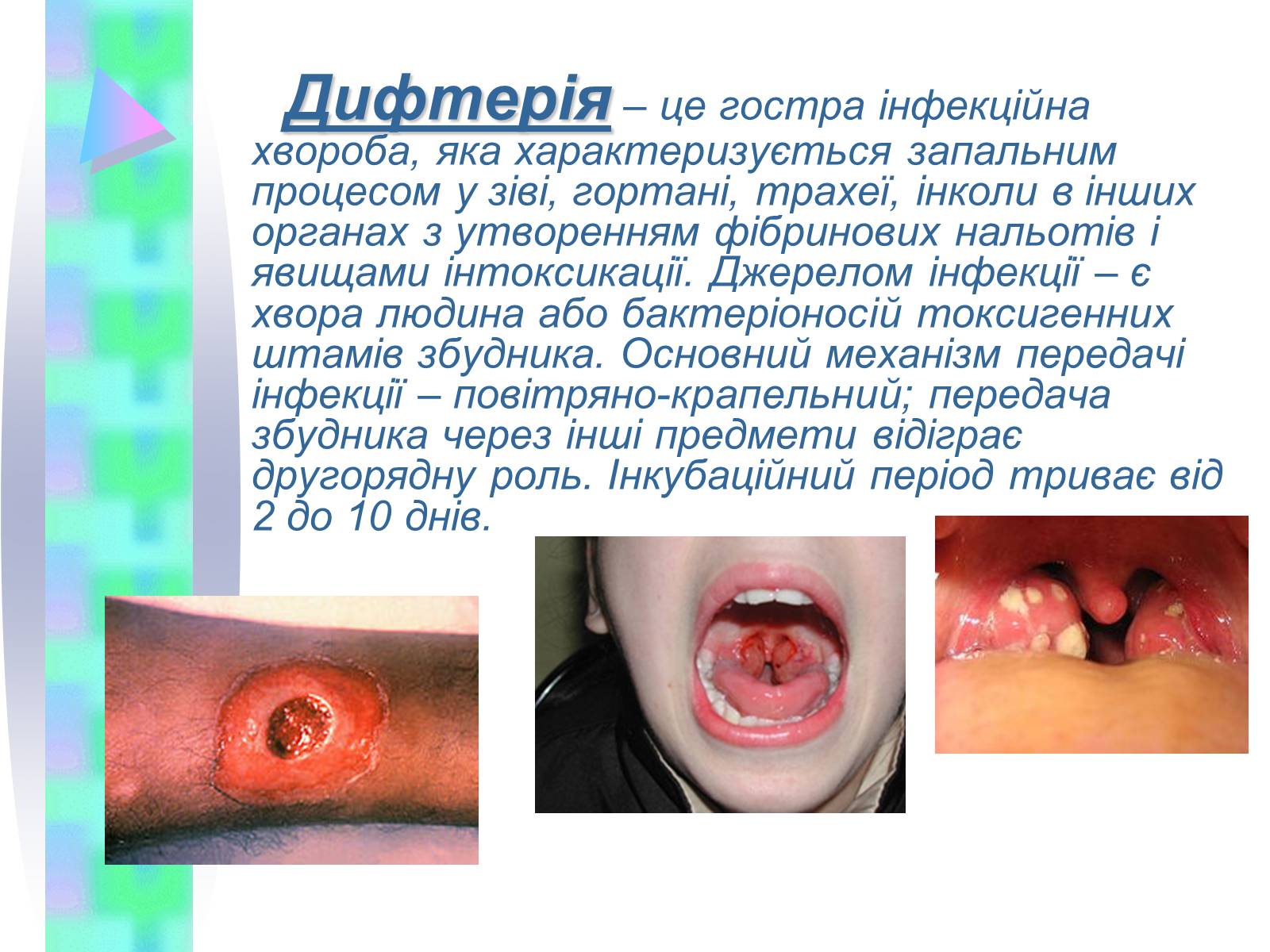 Презентація на тему «Інфекційні захворювання» (варіант 4) - Слайд #8