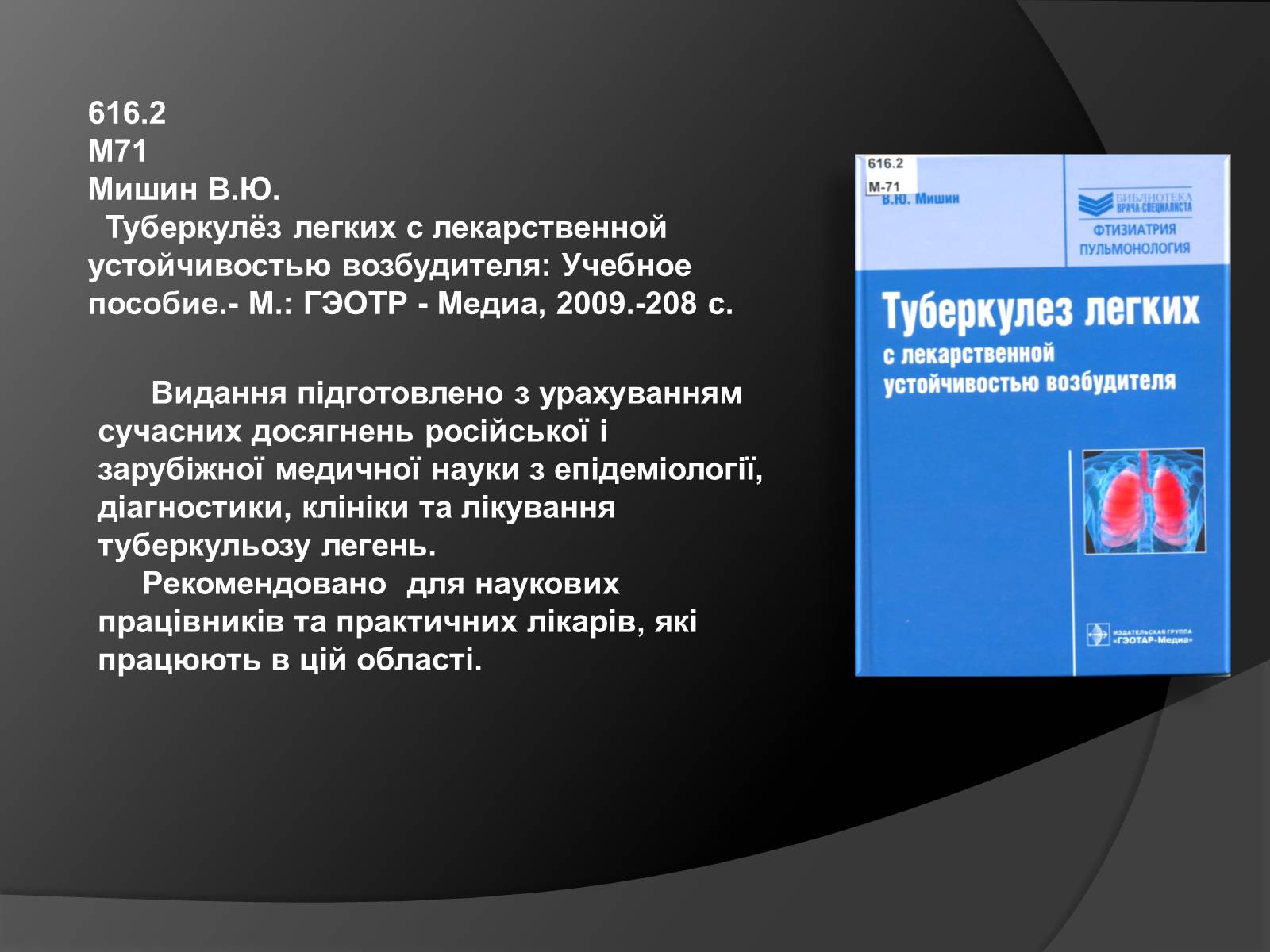 Презентація на тему «Туберкульоз. Сучасні методи діагностики та лікування» - Слайд #11