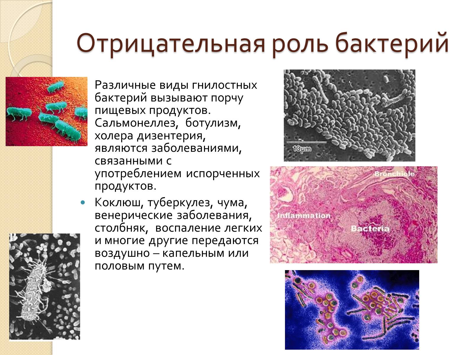 Презентація на тему «Прокариоты» (варіант 3) - Слайд #22