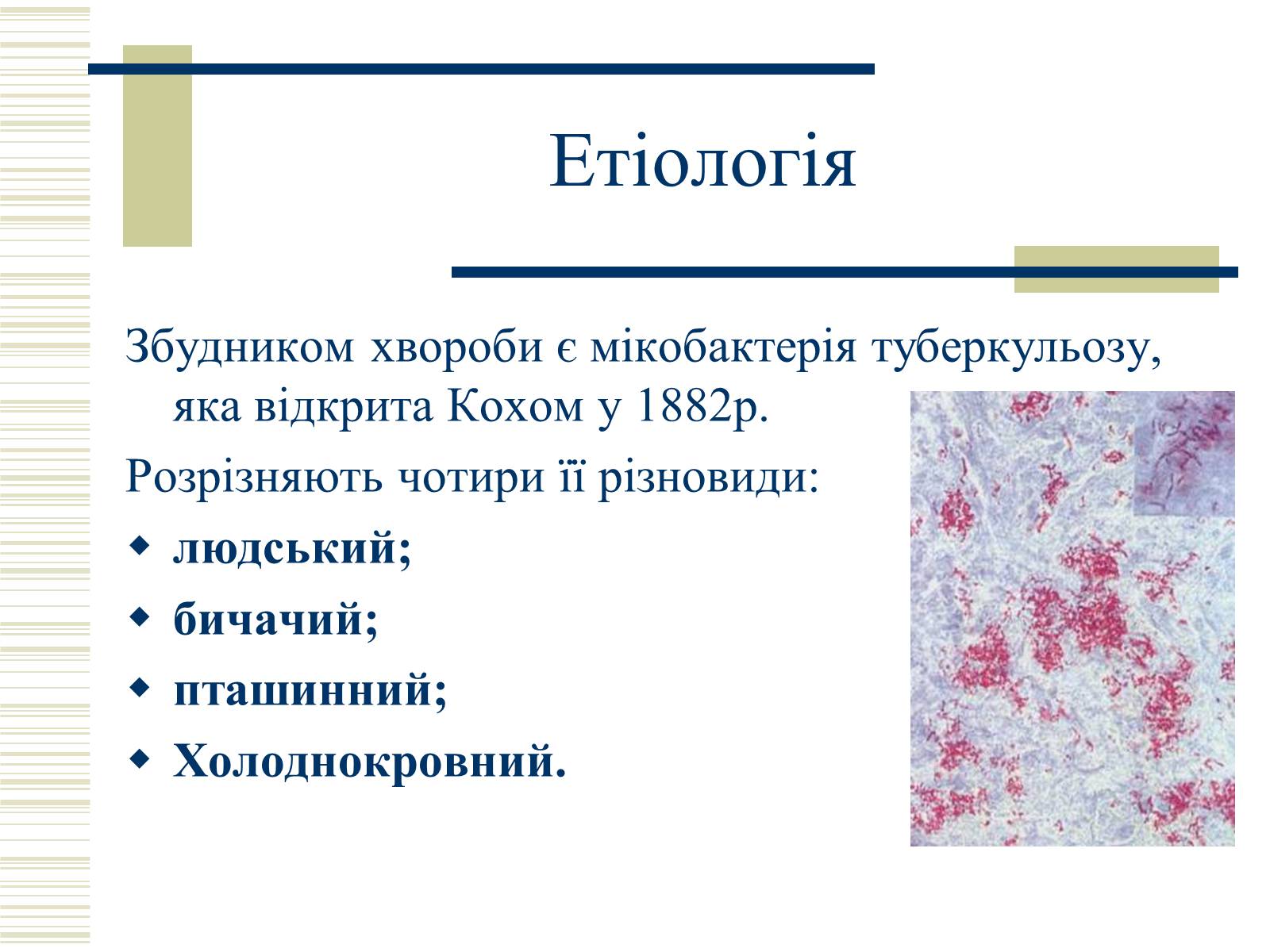 Презентація на тему «Патологічна анатомія туберкульозу» - Слайд #3