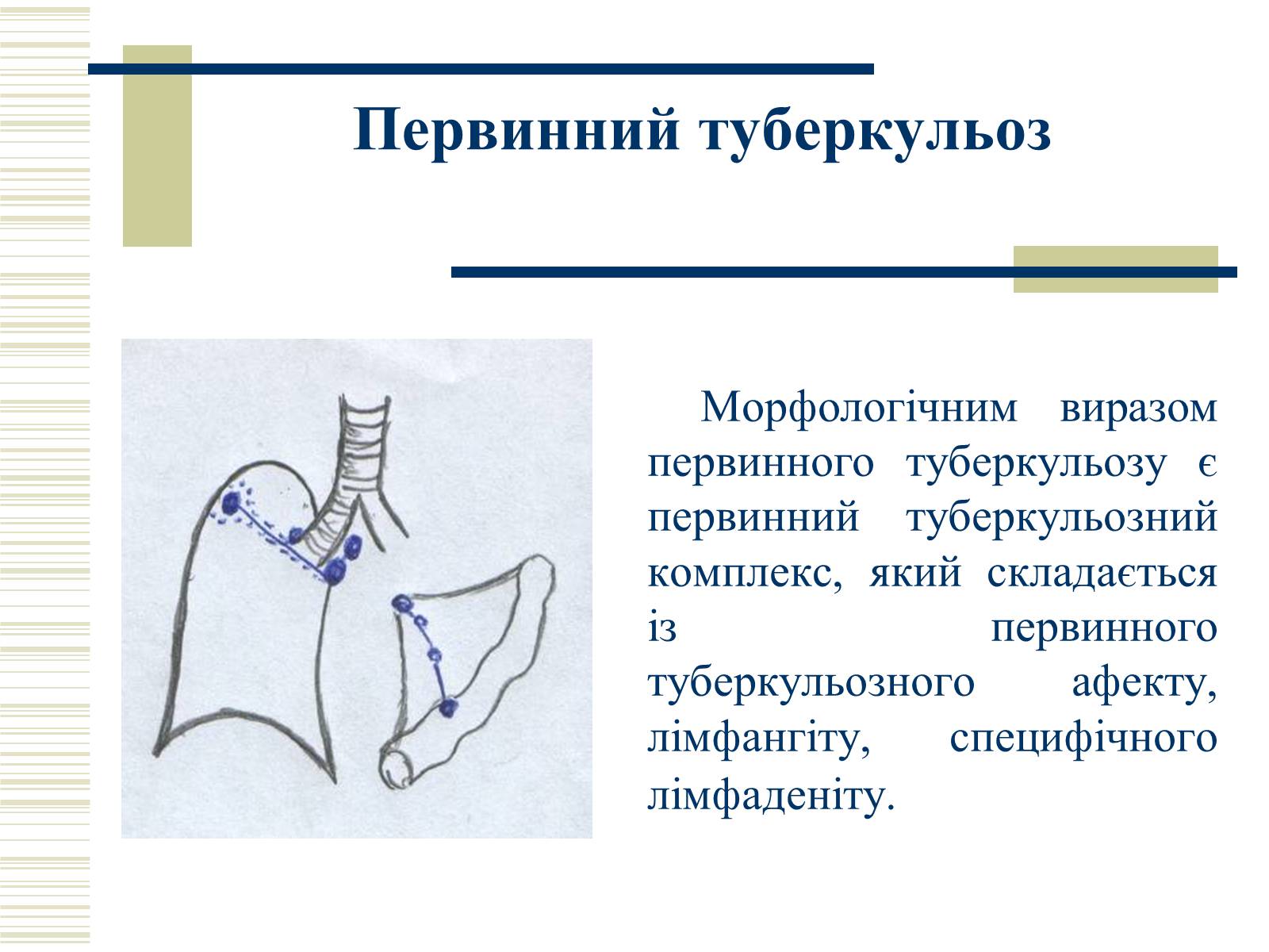 Презентація на тему «Патологічна анатомія туберкульозу» - Слайд #7