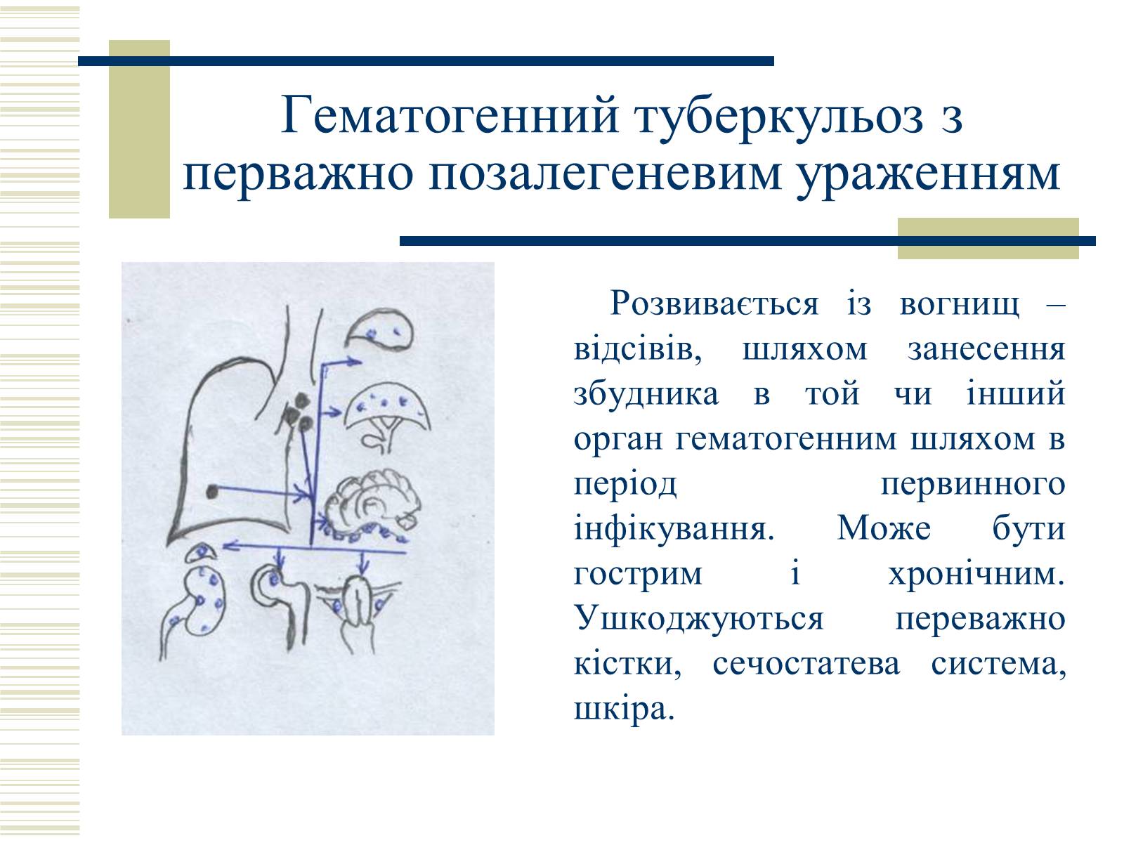 Презентація на тему «Патологічна анатомія туберкульозу» - Слайд #21