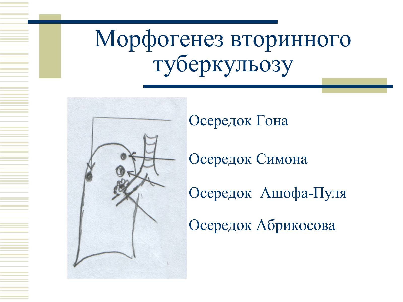 Презентація на тему «Патологічна анатомія туберкульозу» - Слайд #25