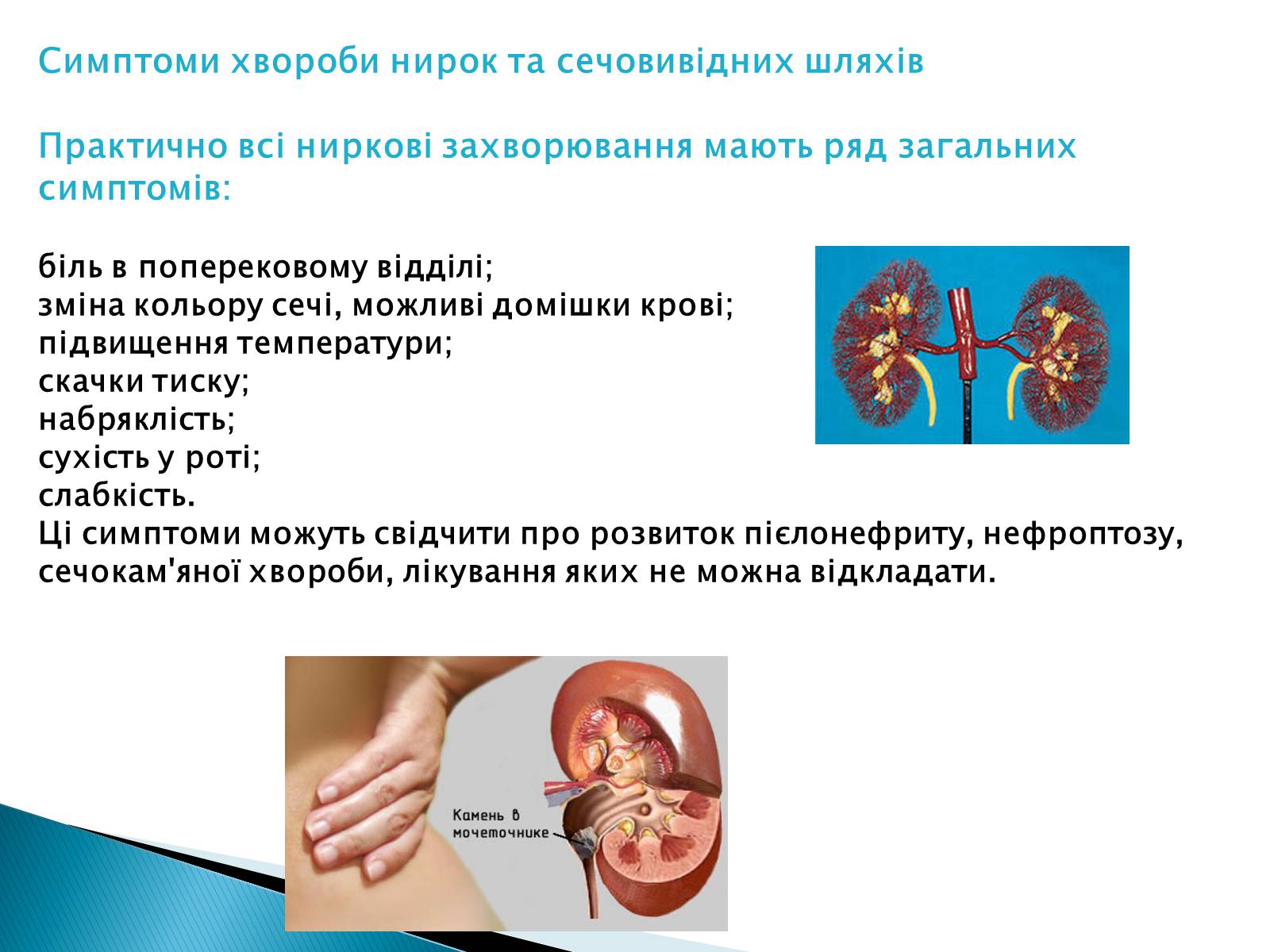 Презентація на тему «Захворювання нирок і сечовивідних шляхів» - Слайд #4