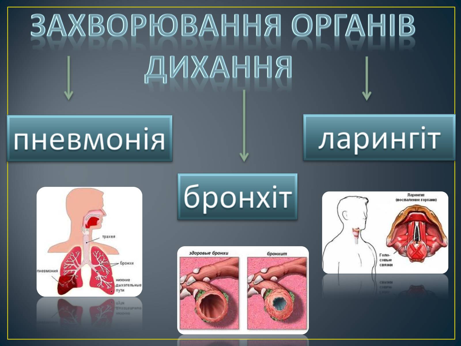 Презентація на тему «Захворювання органів дихання» - Слайд #2