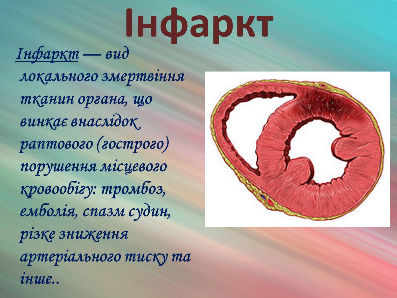 Презентація на тему «Захворювання органів кровообігу» - Слайд #24
