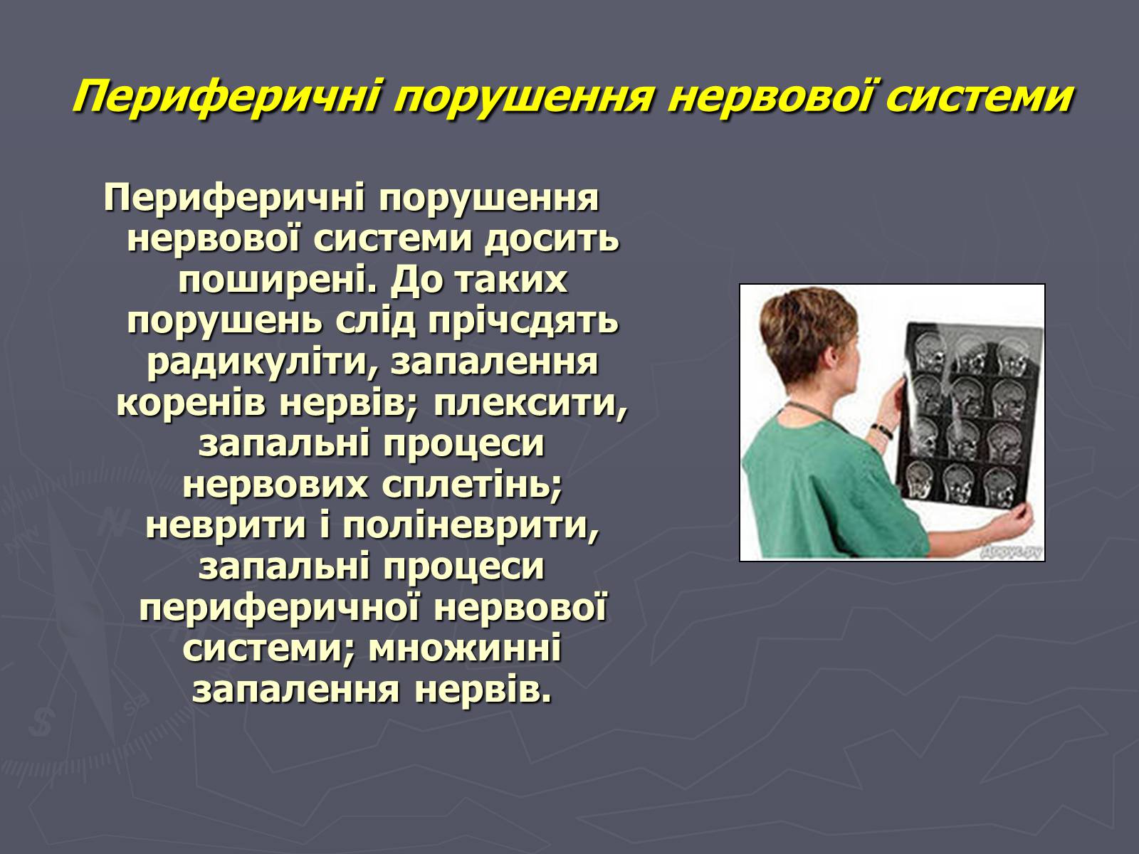 Презентація на тему «Хвороби нервової системи» - Слайд #9