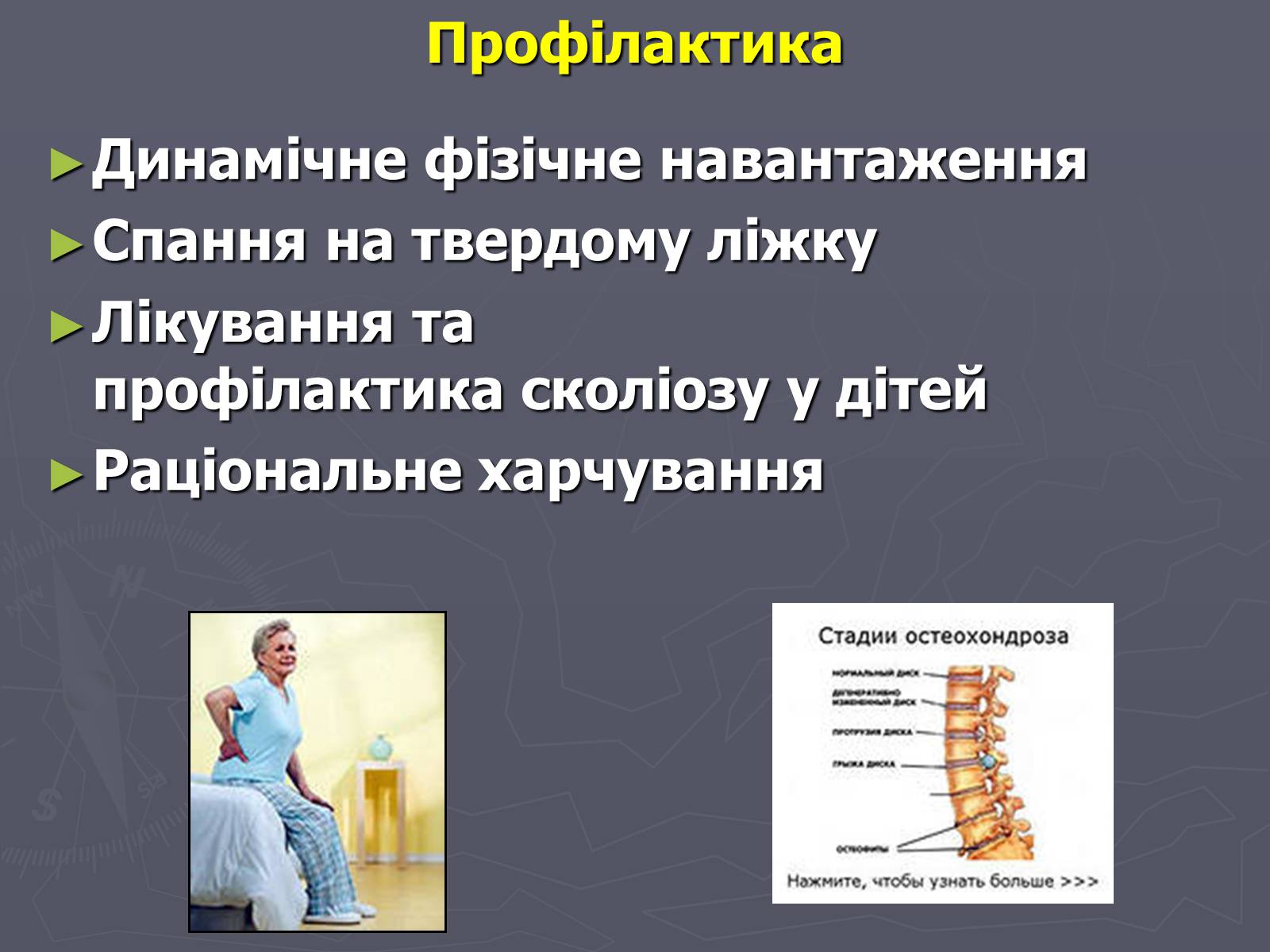 Презентація на тему «Хвороби нервової системи» - Слайд #13