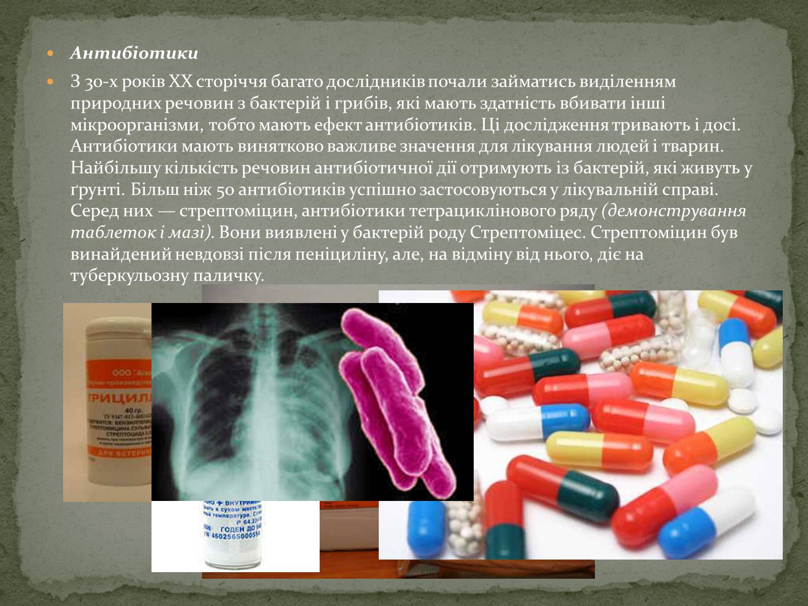 Презентація на тему «Корисні бактерії» (варіант 1) - Слайд #17