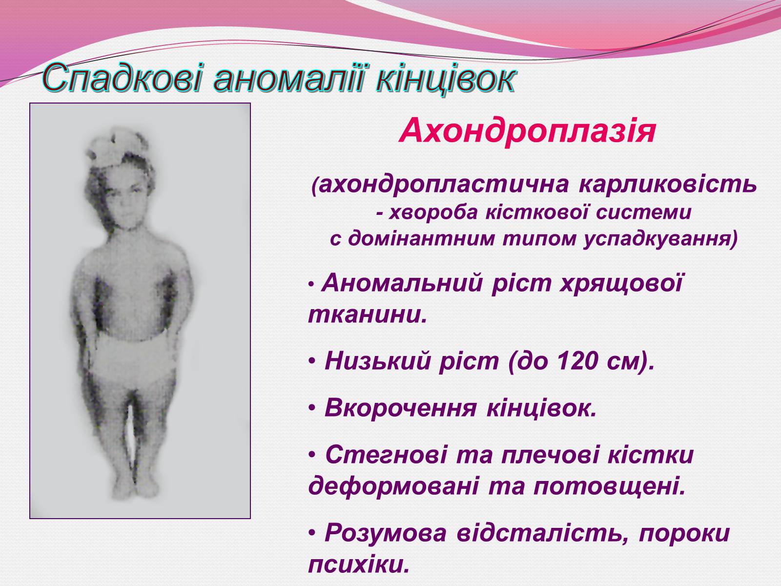 Презентація на тему «Генетика людини» (варіант 3) - Слайд #14