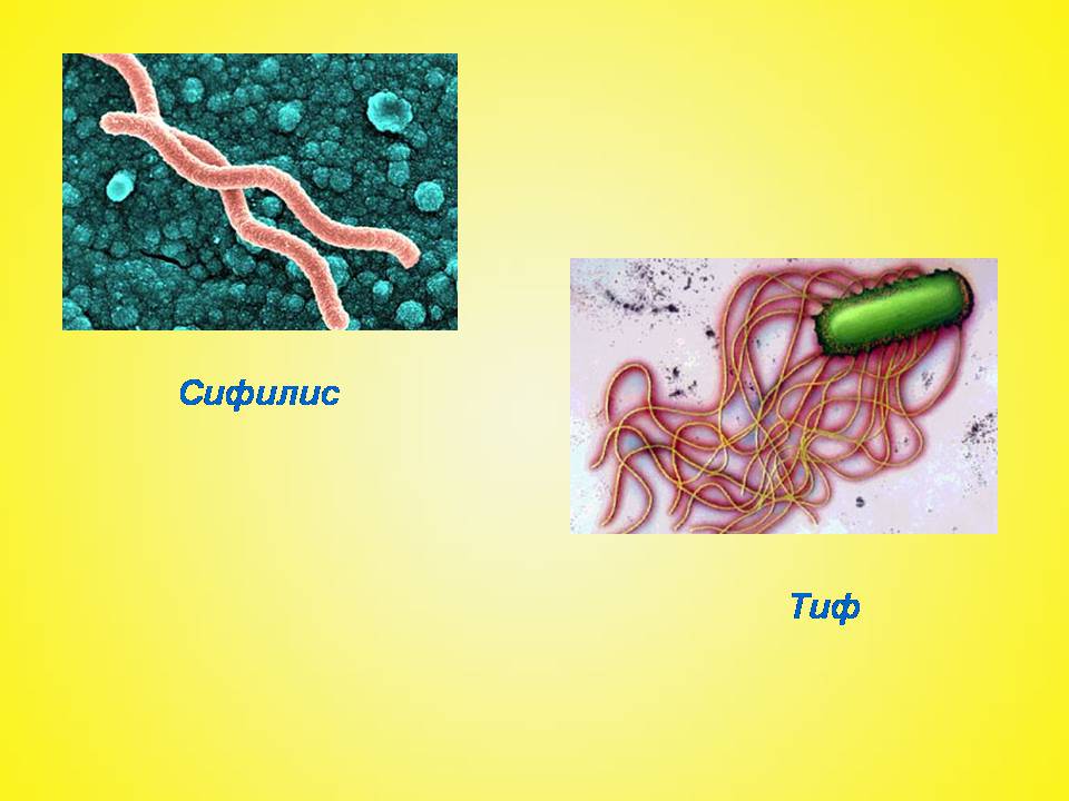 Презентація на тему «Бактериальные заболевания и их профилактика» - Слайд #7
