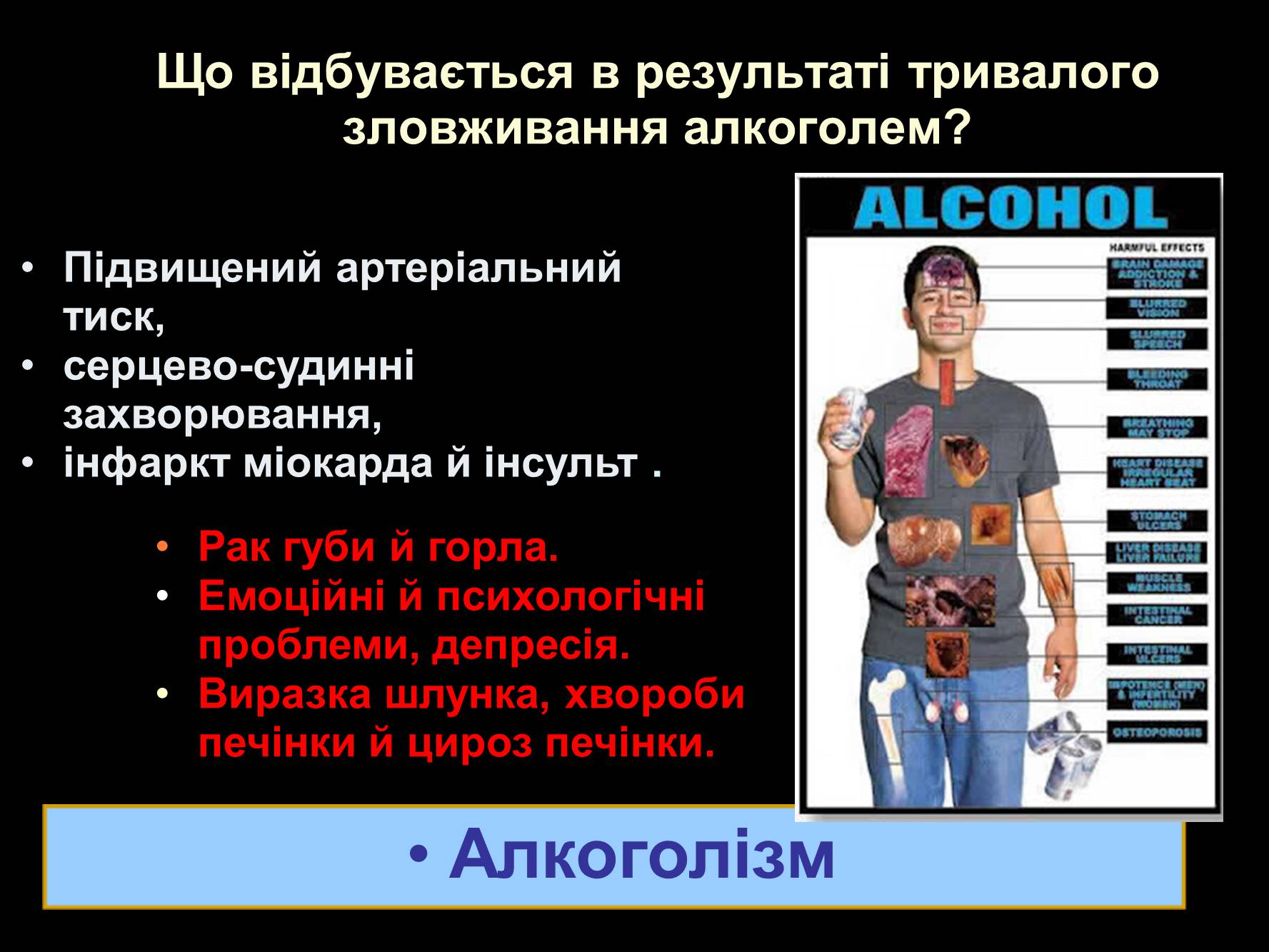 Презентація на тему «Алкоголь» (варіант 2) - Слайд #14