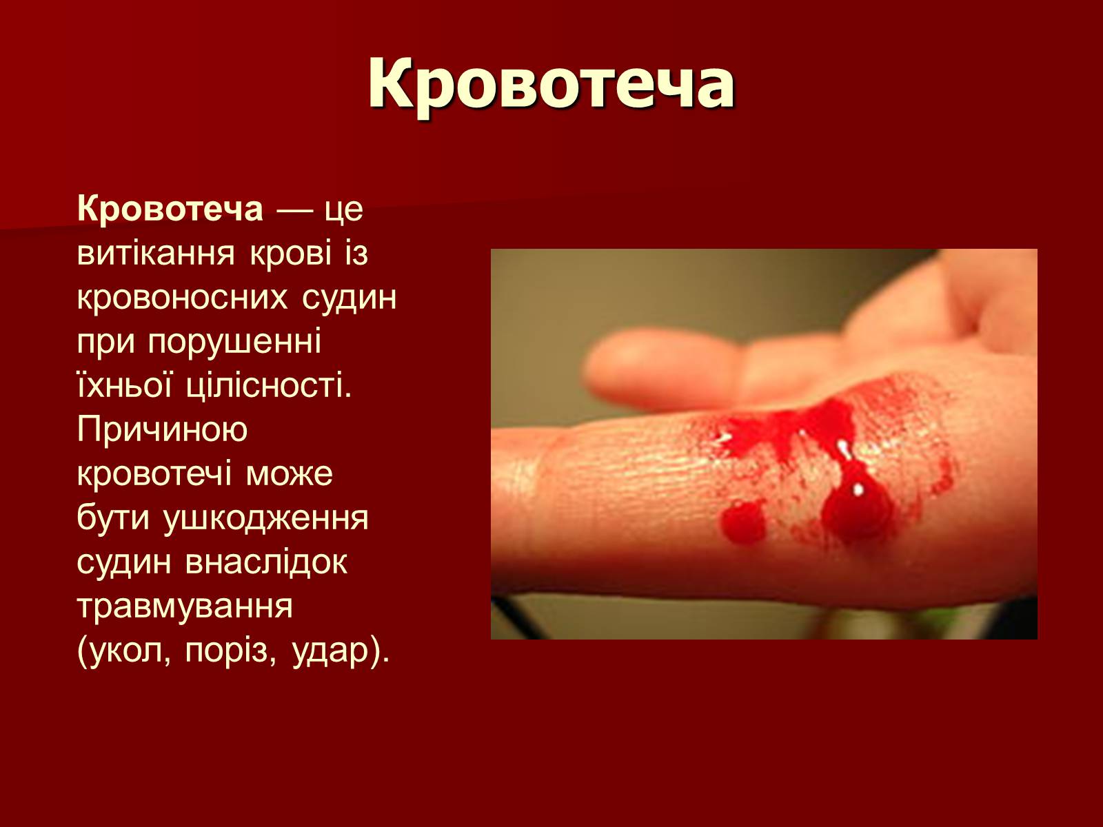 Презентація на тему «Кровотечі, їх класифікація» - Слайд #2