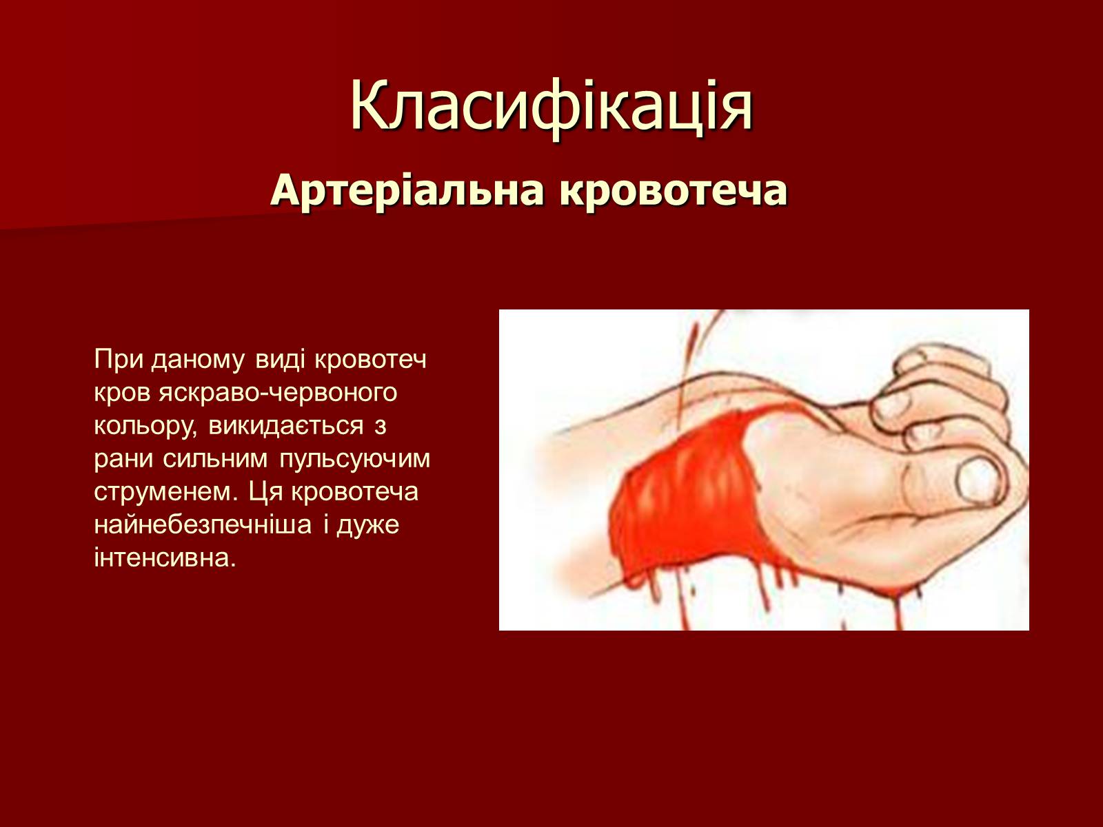 Презентація на тему «Кровотечі, їх класифікація» - Слайд #5