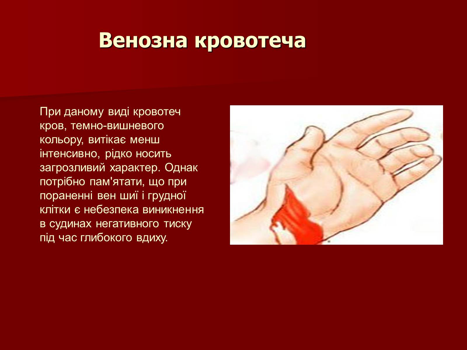 Презентація на тему «Кровотечі, їх класифікація» - Слайд #6