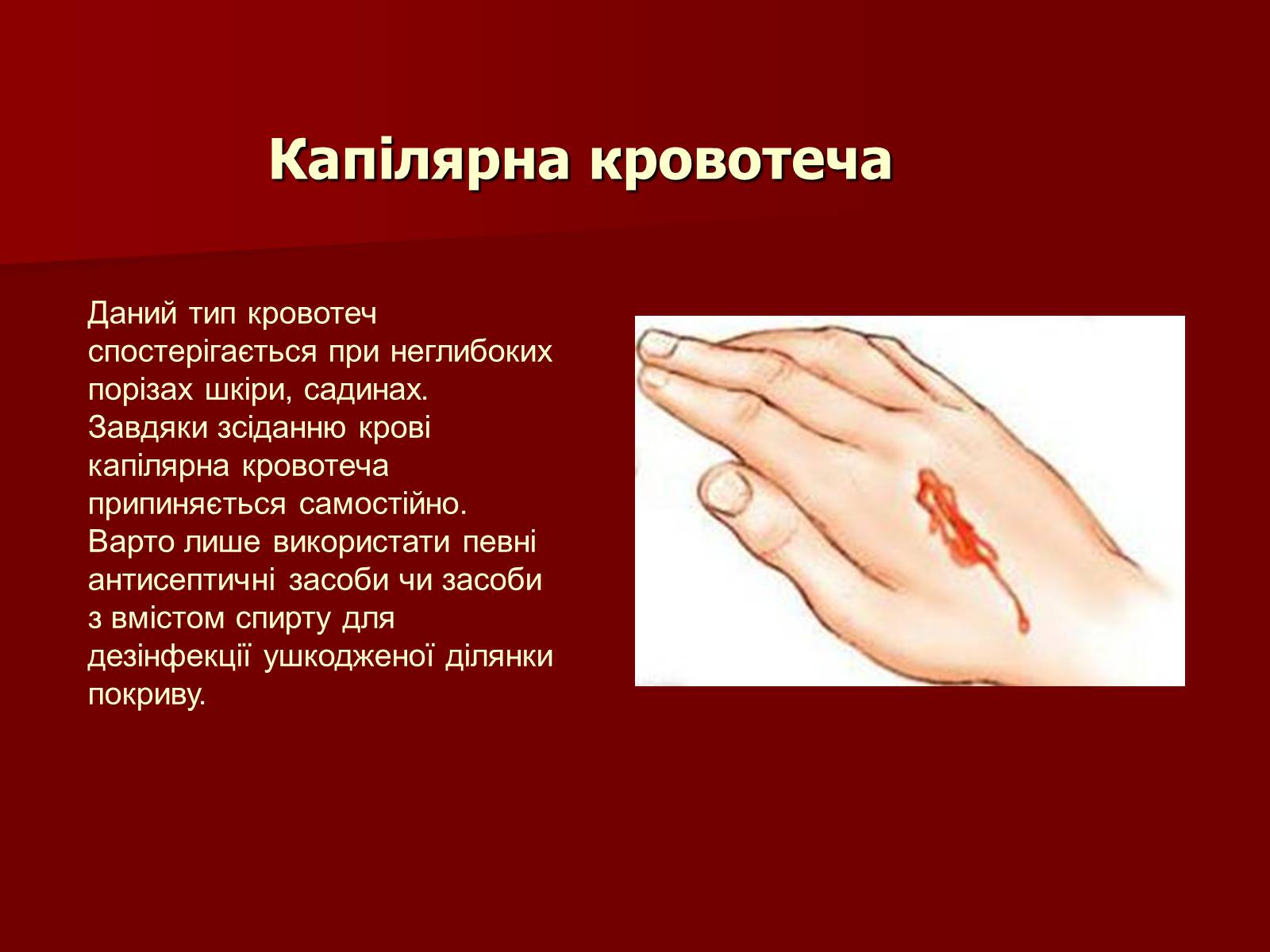 Презентація на тему «Кровотечі, їх класифікація» - Слайд #7