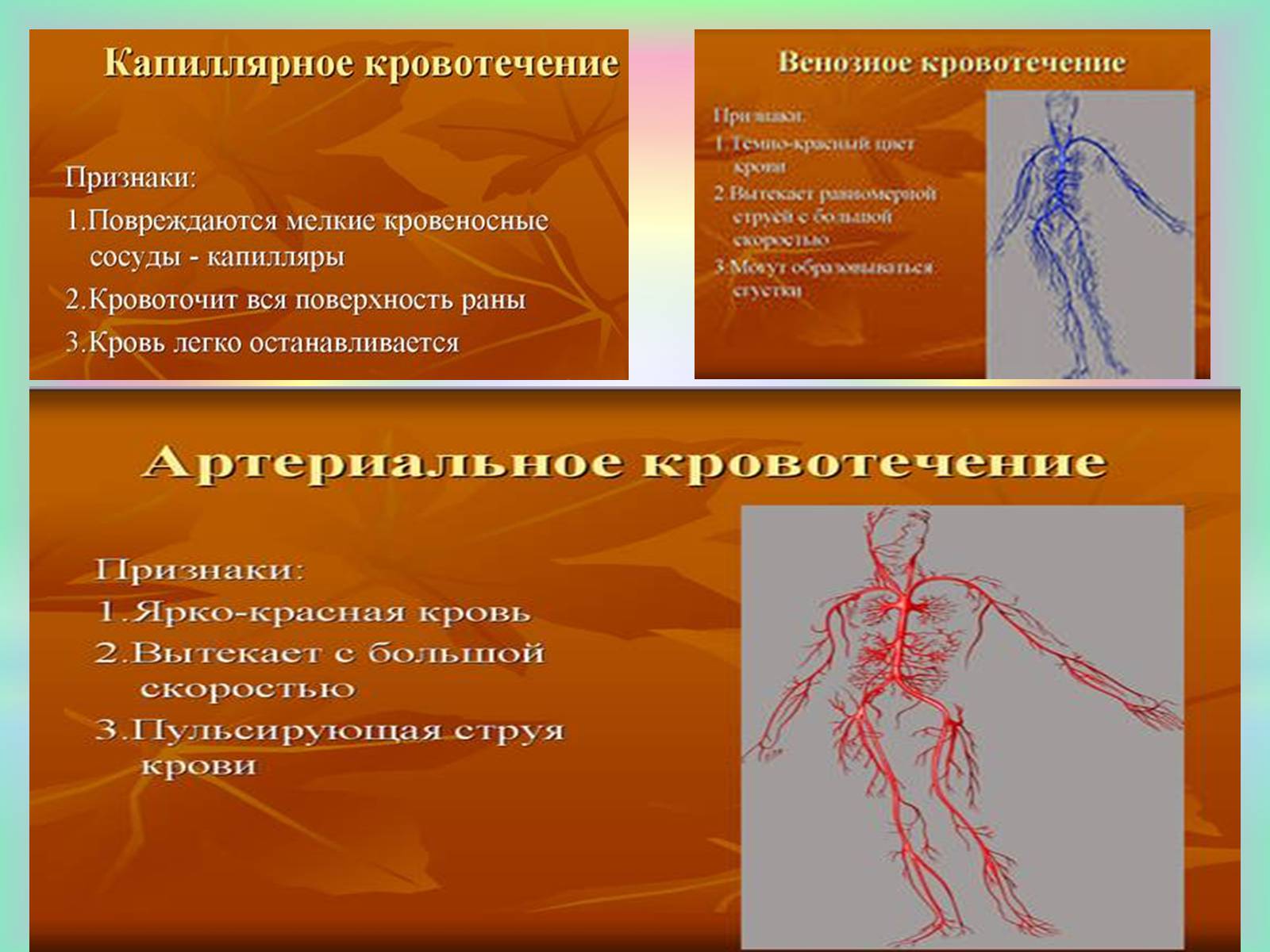 Презентація на тему «Кровоносна система» (варіант 1) - Слайд #22