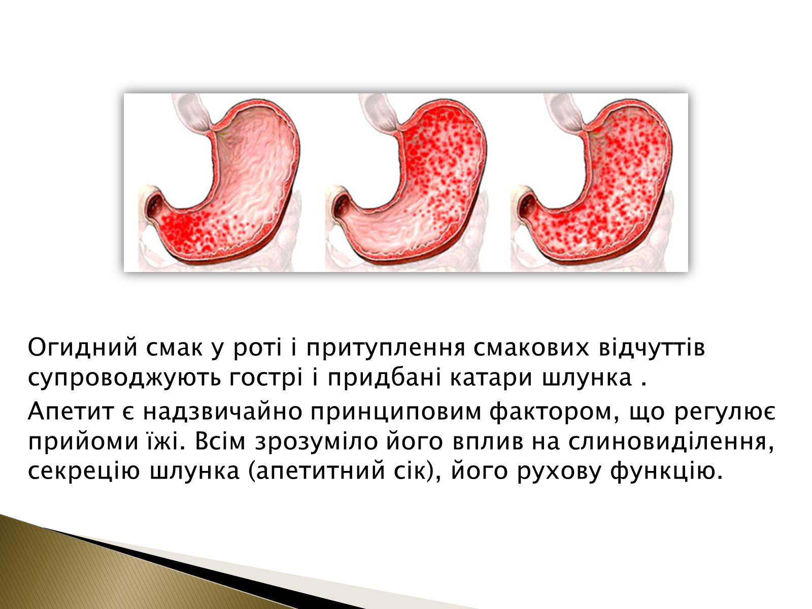 Презентація на тему «Ознаки захворювань шлунка» - Слайд #4