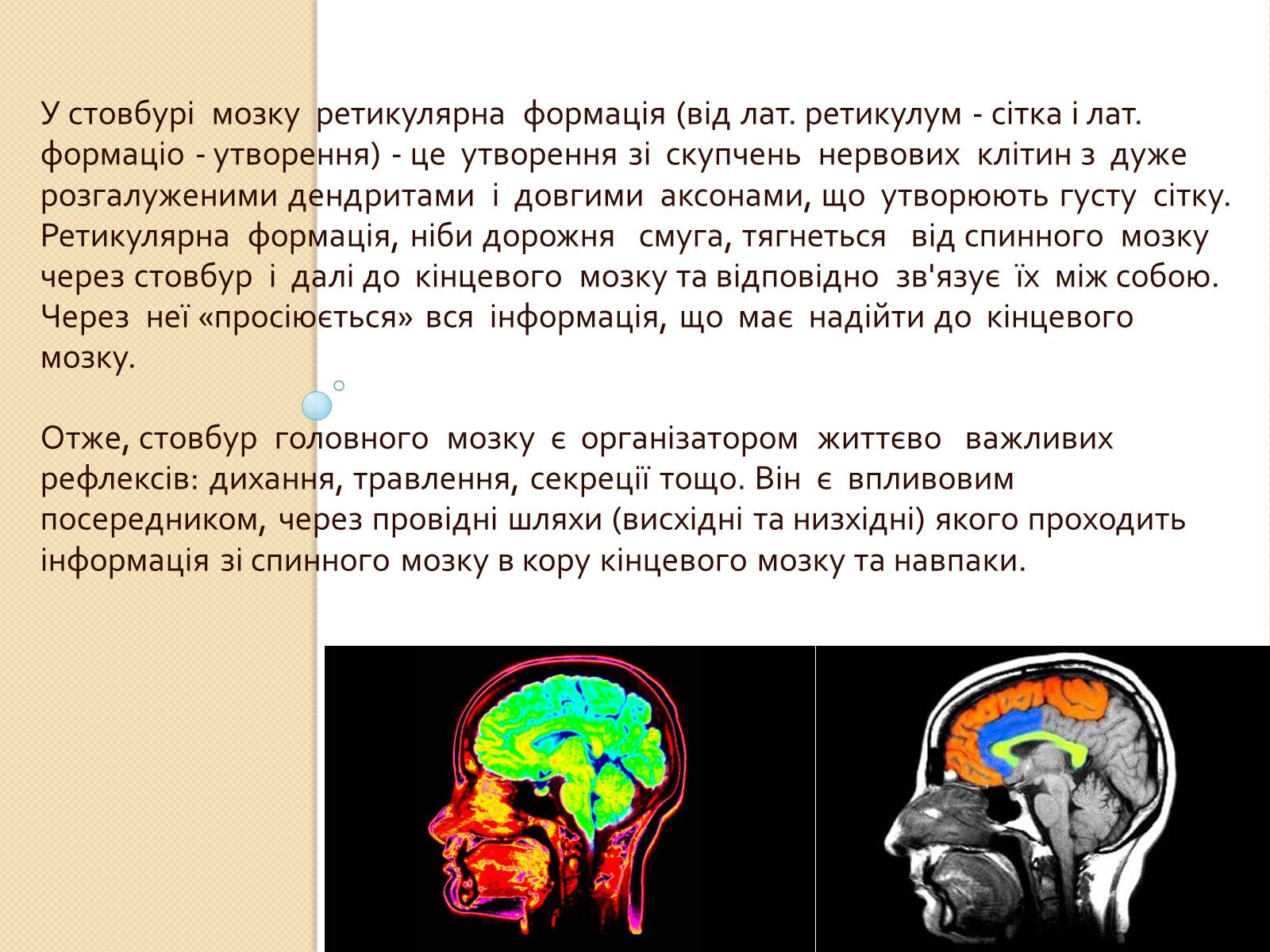 Презентація на тему «Головний мозок. Особливості його відділів» - Слайд #8