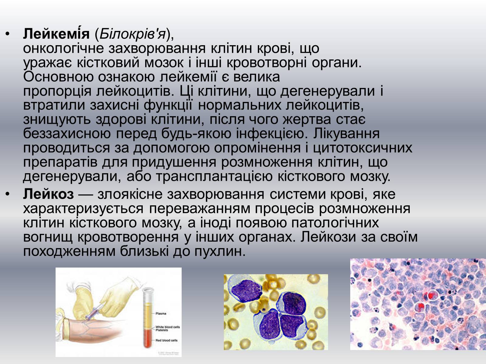 Презентація на тему «Хвороби клітини» - Слайд #5