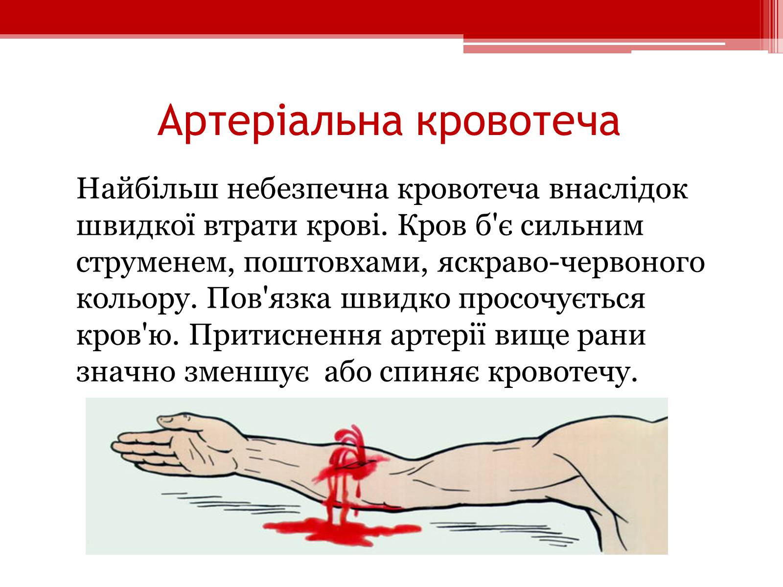 Презентація на тему «Перша допомога при кровотечах» (варіант 1) - Слайд #8